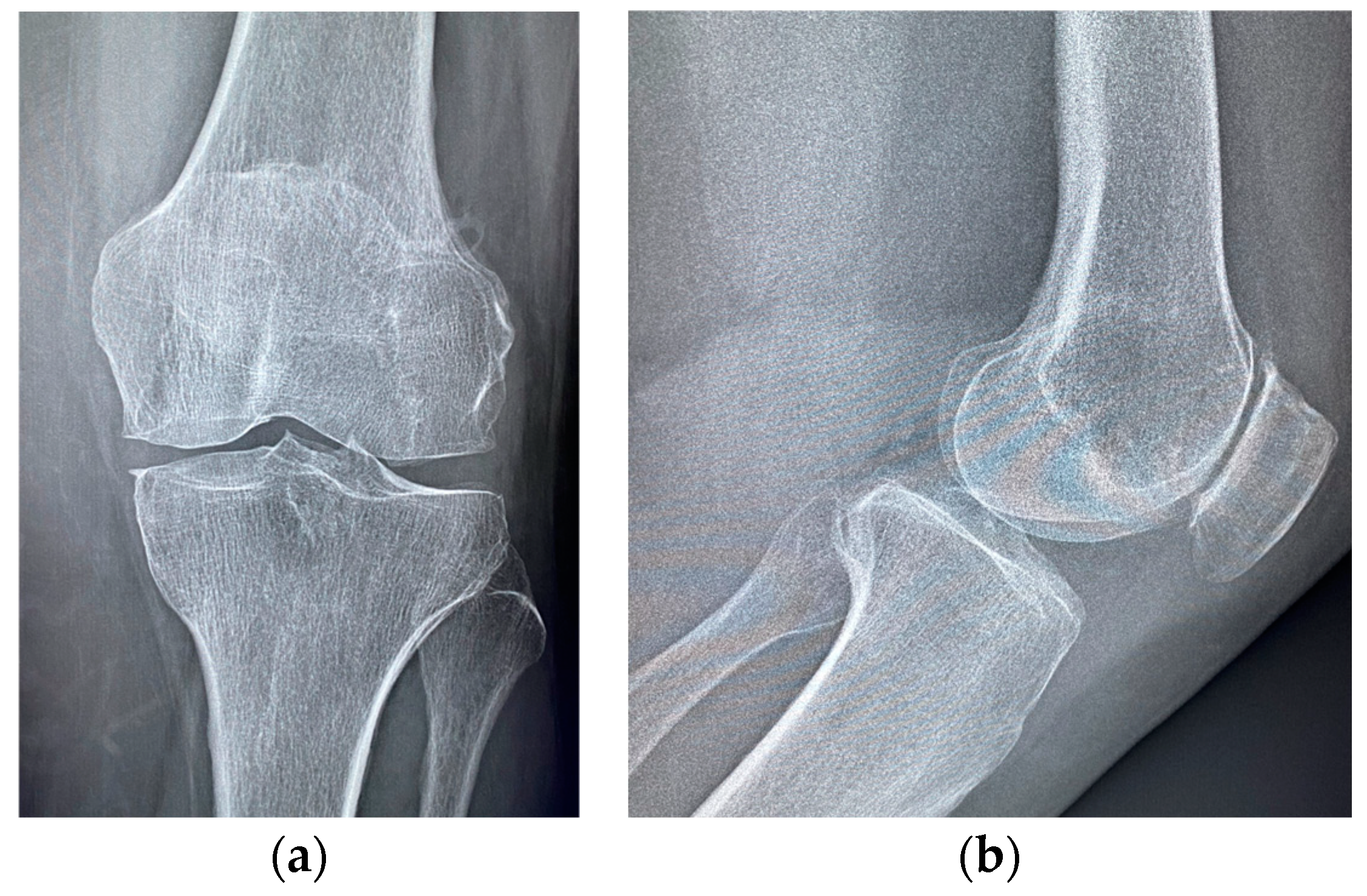 Medicina 60 01636 g007 Medicina 60 01636 g007