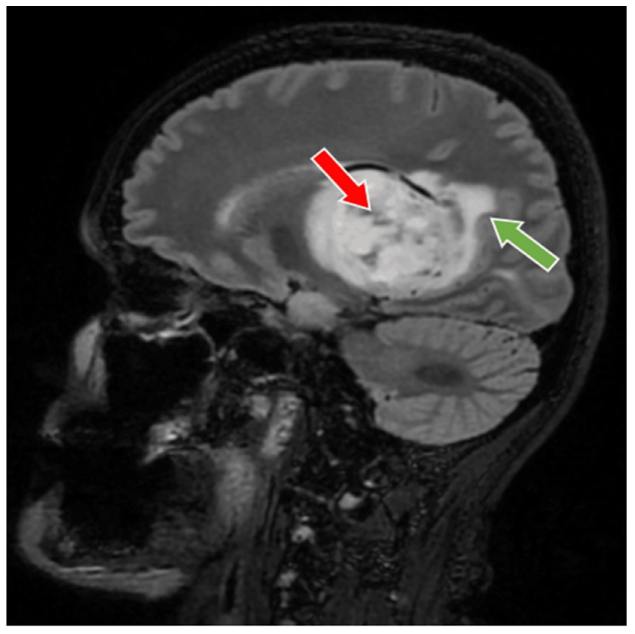 Medicina 60 01667 g003 Medicina 60 01667 g003