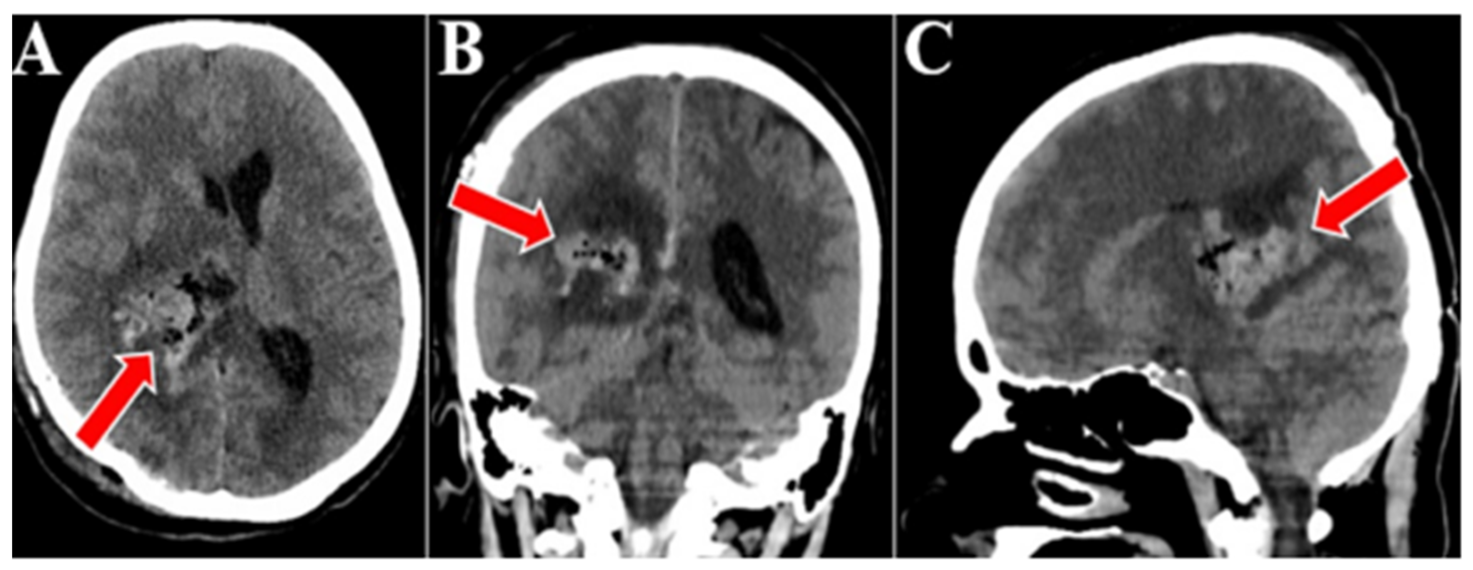 Medicina 60 01667 g004 Medicina 60 01667 g004