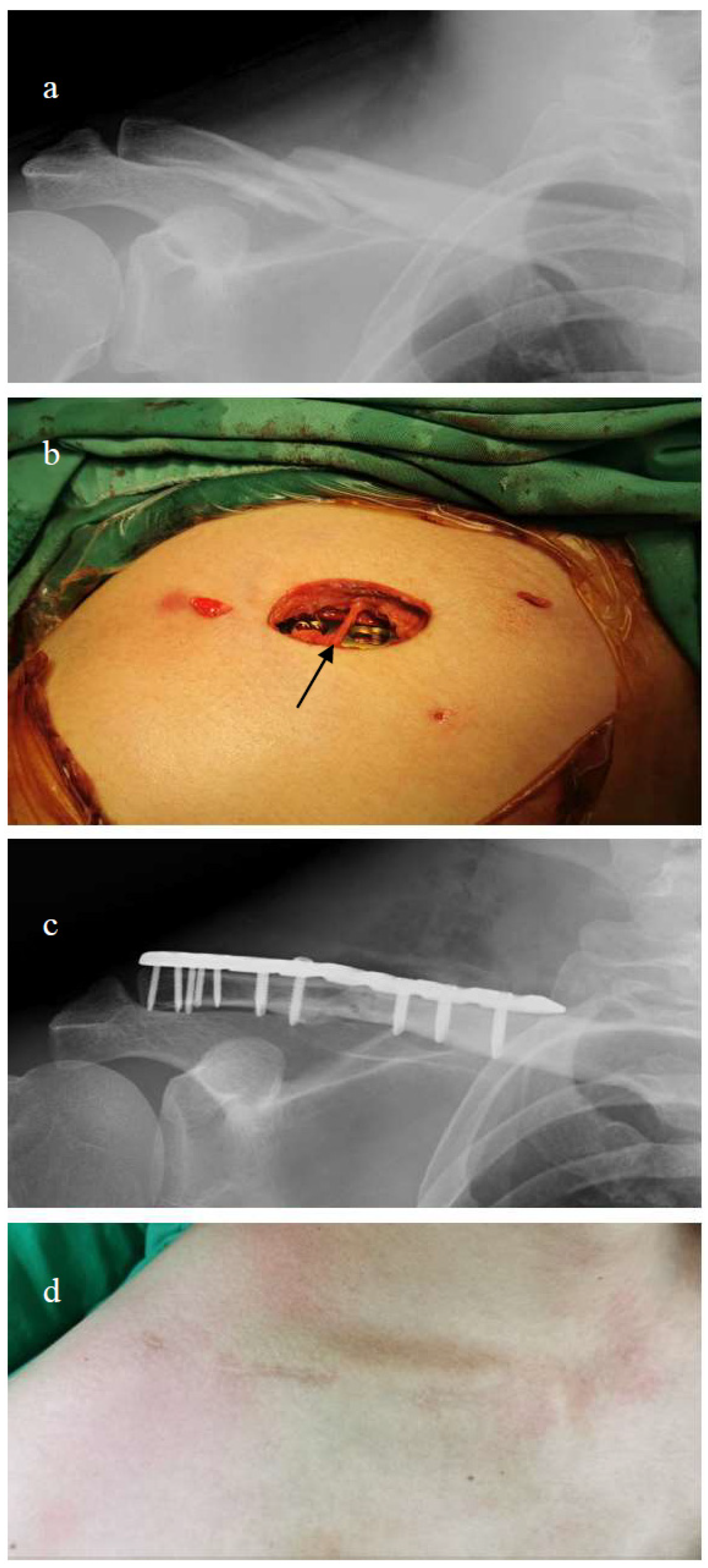 Medicina 60 01669 g002 Medicina 60 01669 g002
