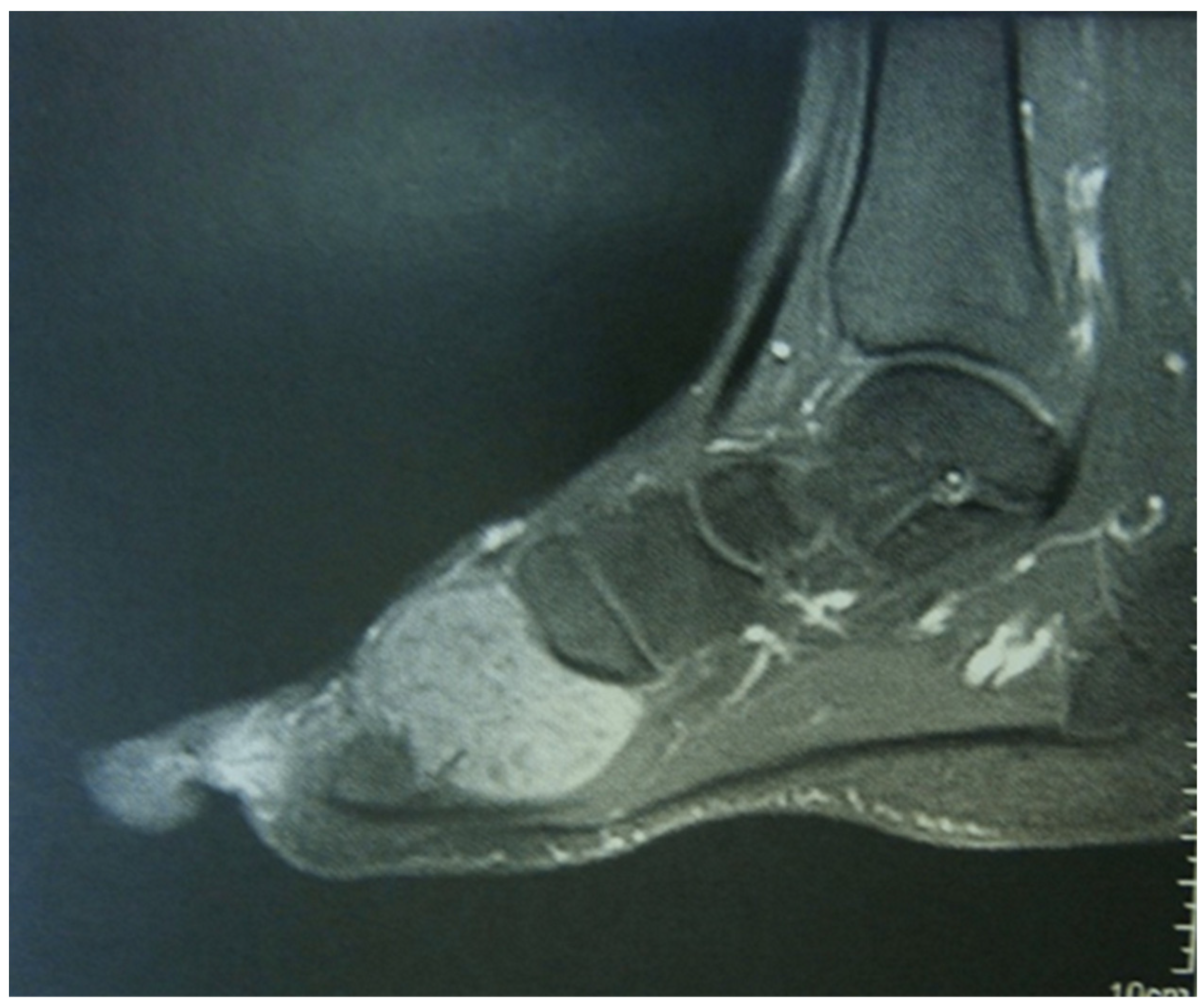 Medicina 60 01675 g002