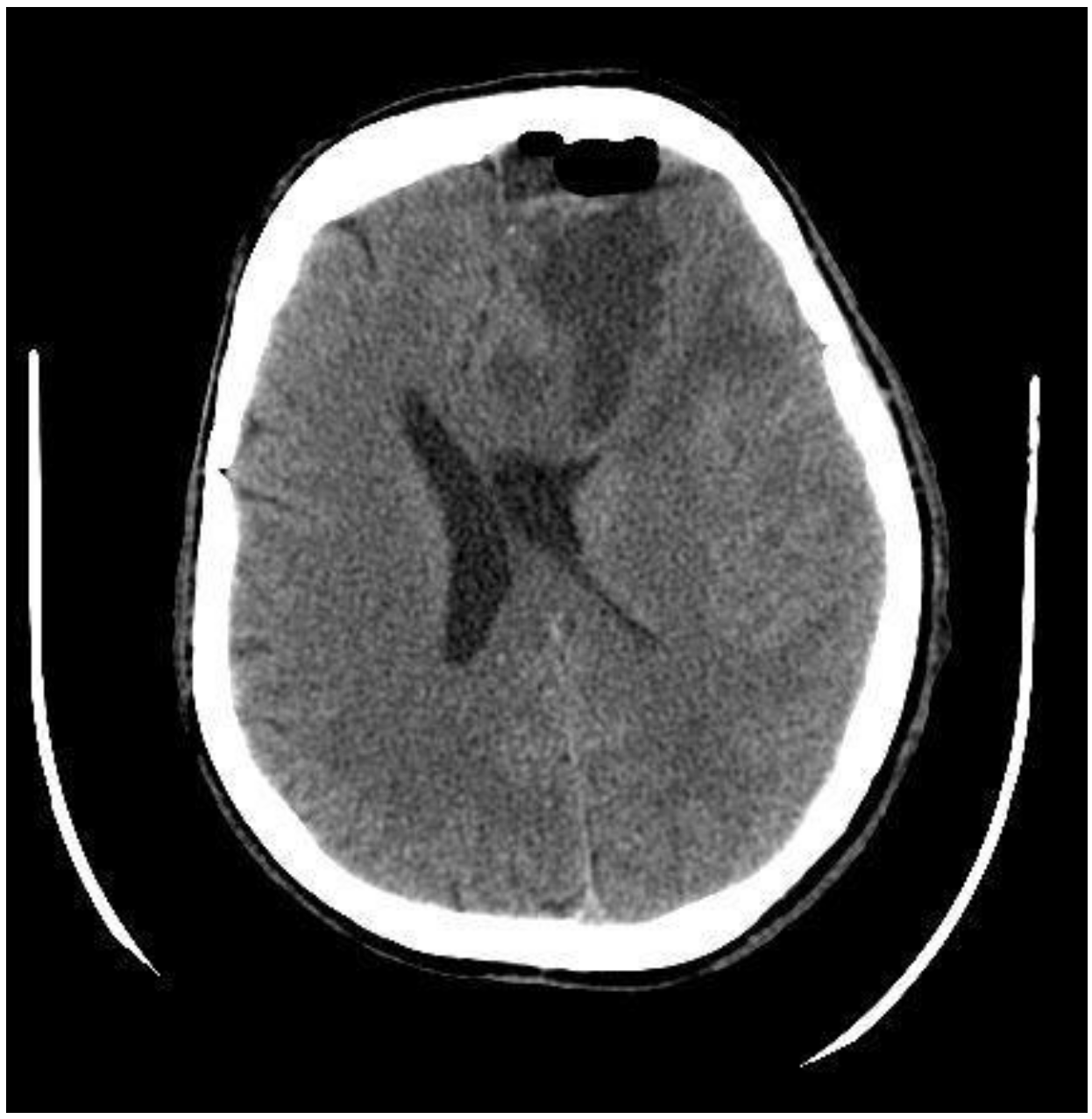 Medicina 60 01688 g002