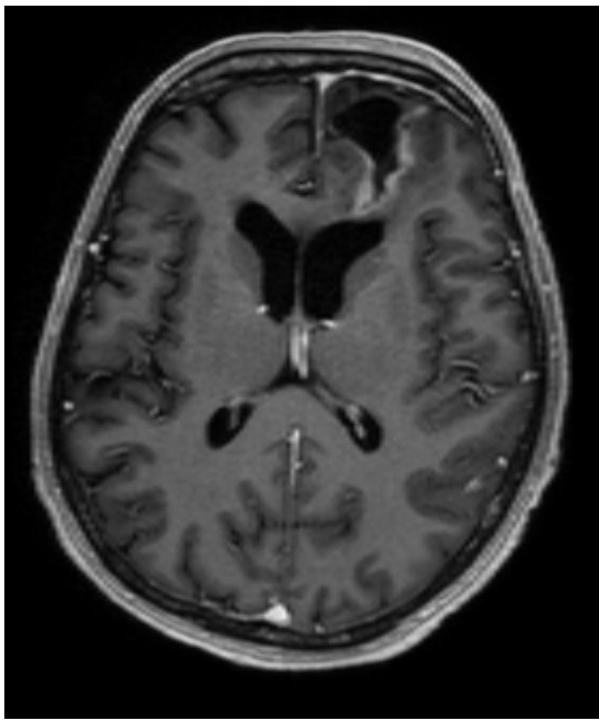 Medicina 60 01688 g003