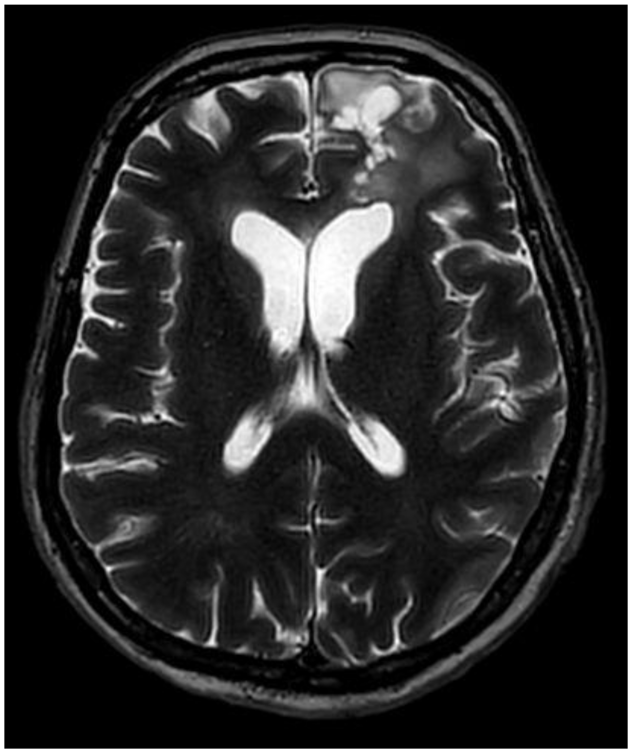 Medicina 60 01688 g004