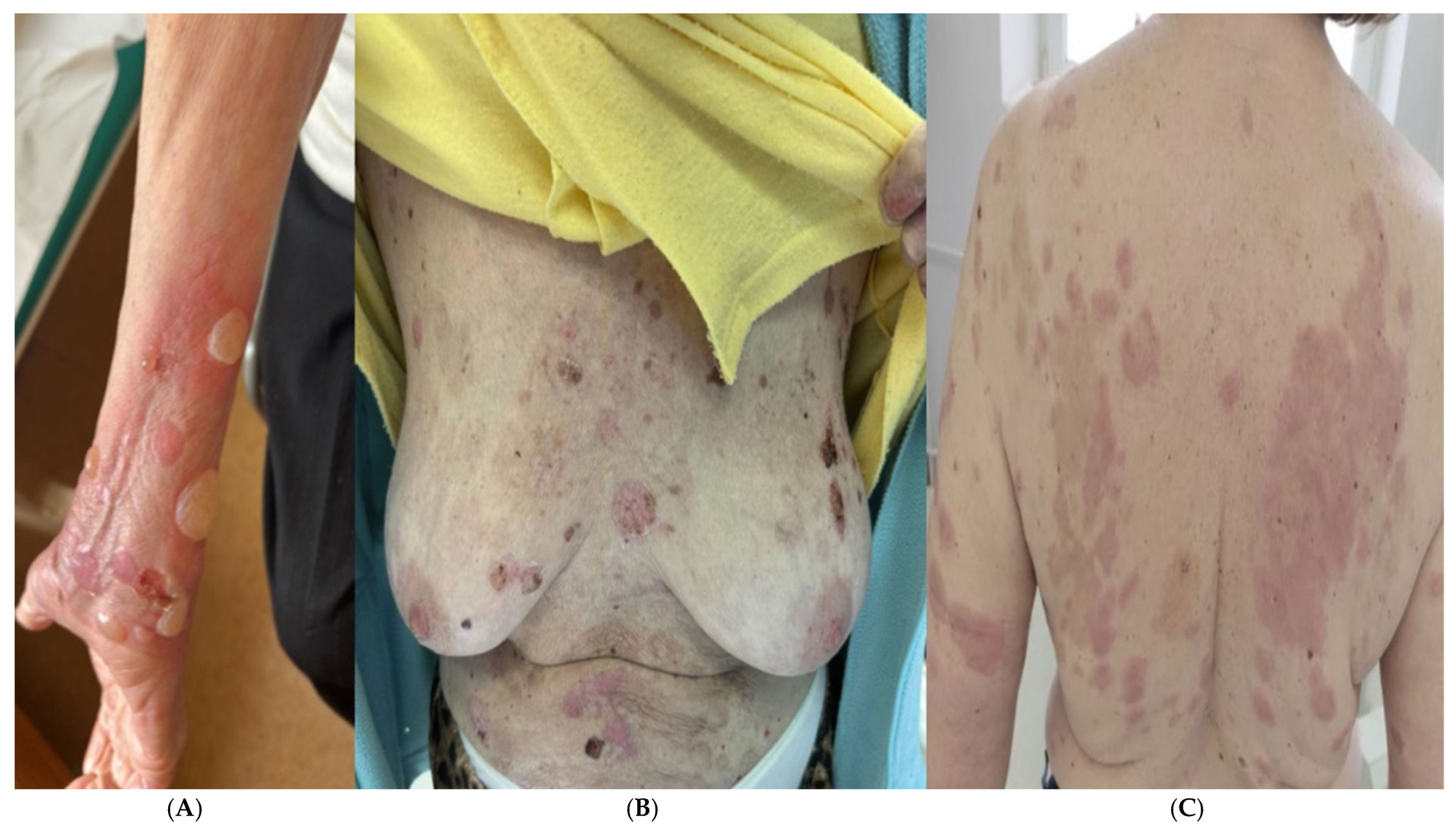 Medicina 60 01701 g001