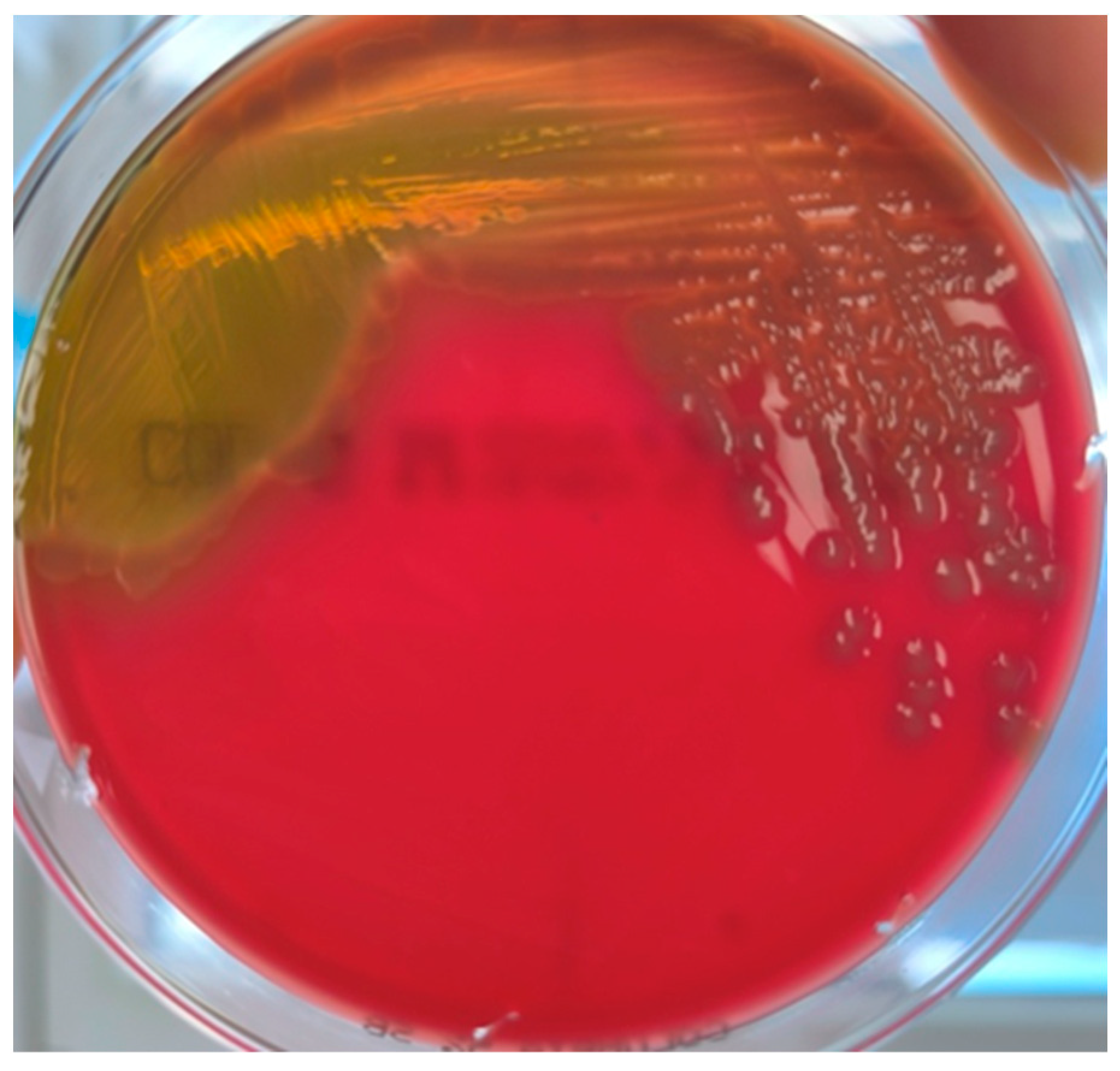 Medicina 60 01748 g001