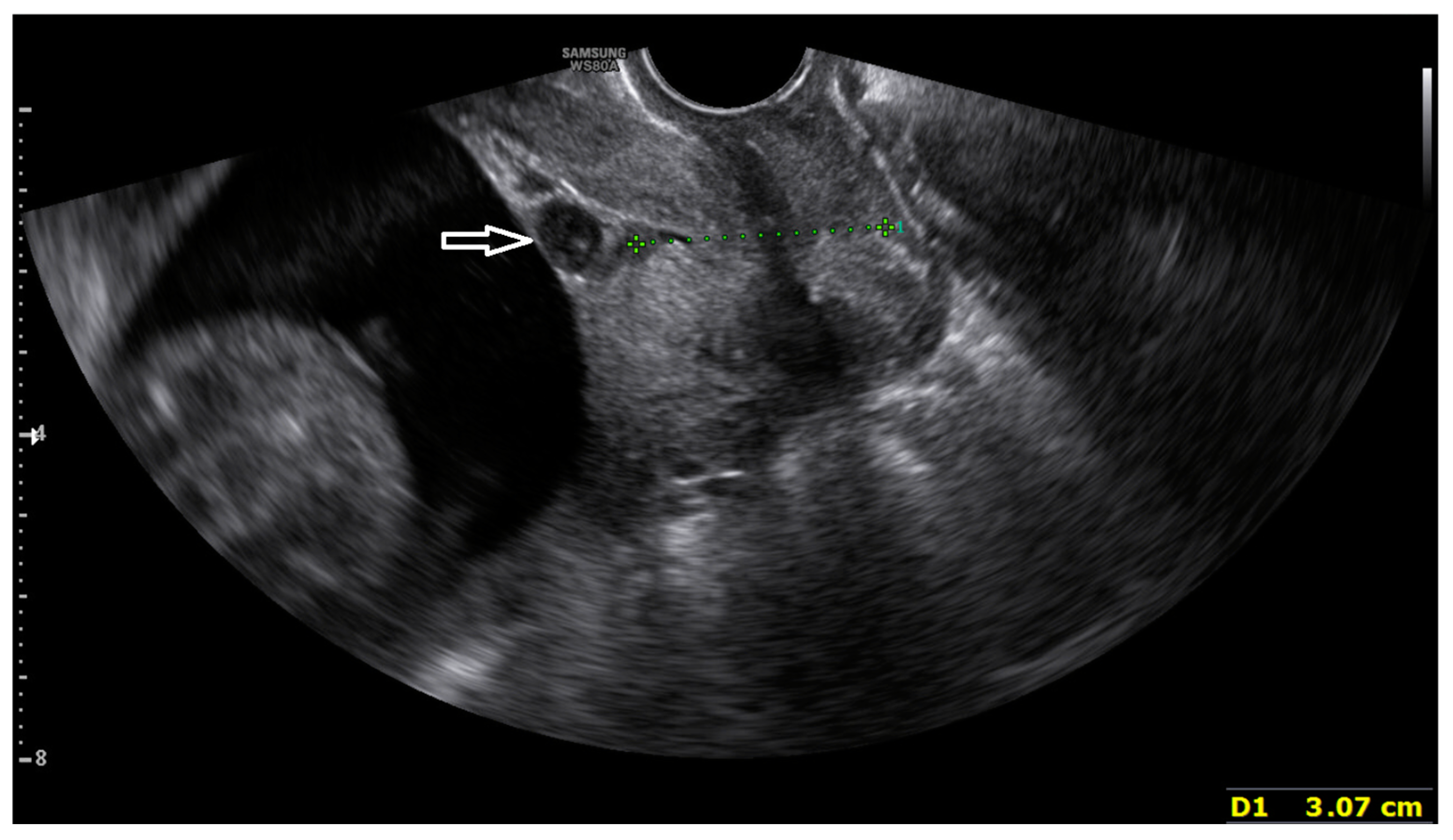 Medicina 60 01800 g001