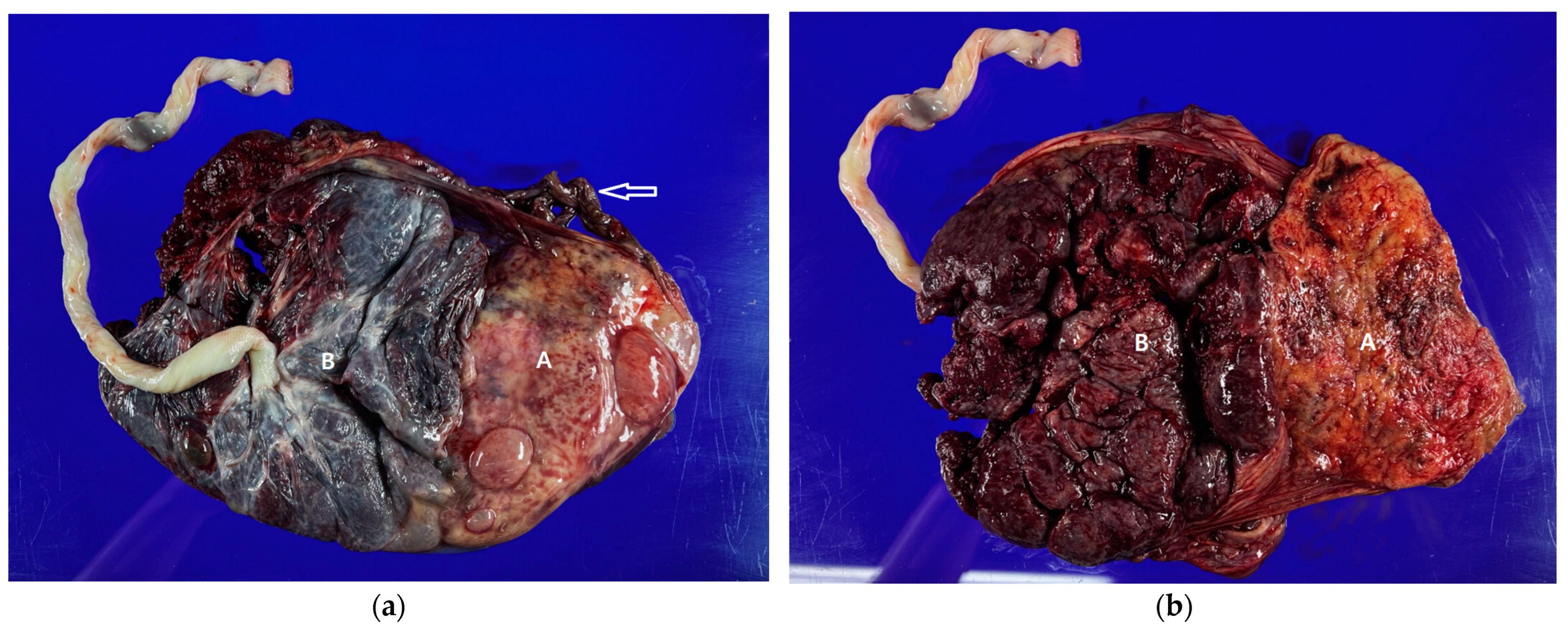 Medicina 60 01800 g003