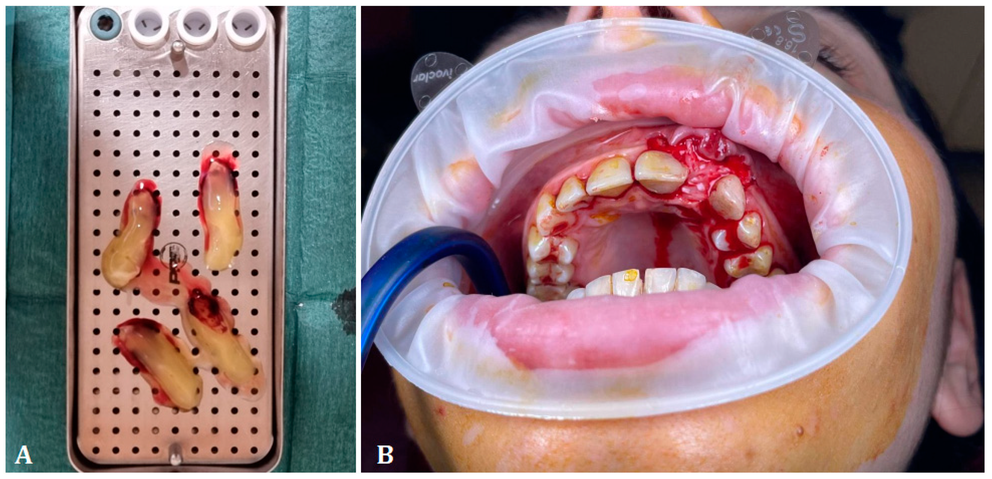 Medicina 60 01897 g001
