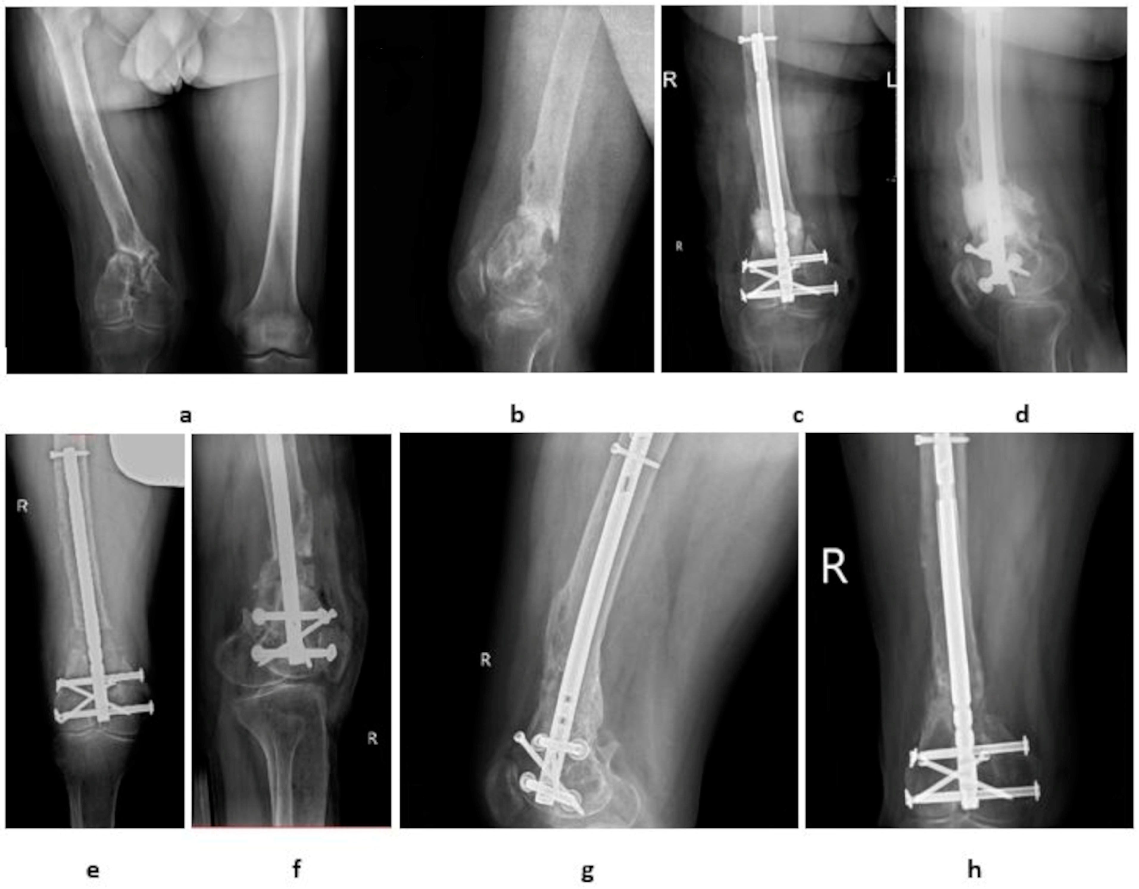 Medicina 60 01933 g001 Medicina 60 01933 g001