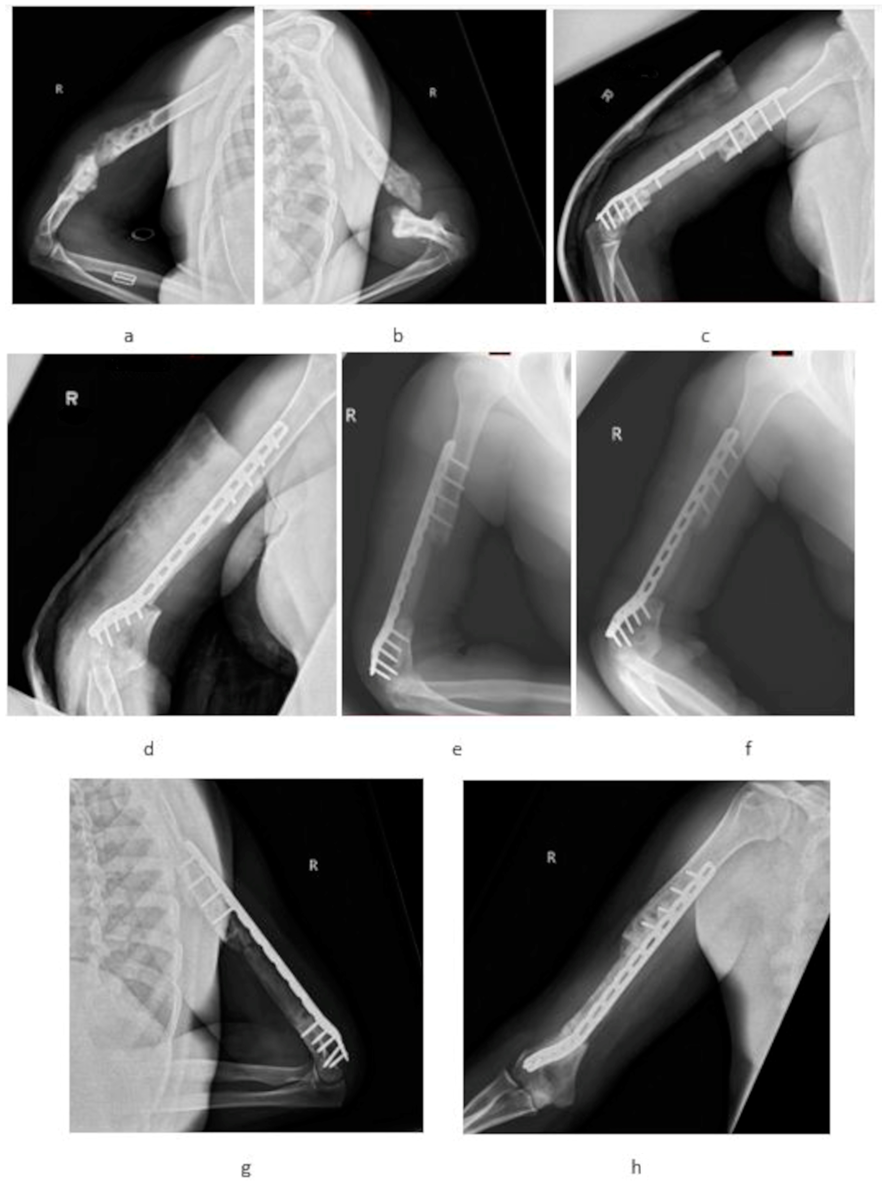 Medicina 60 01933 g002 Medicina 60 01933 g002
