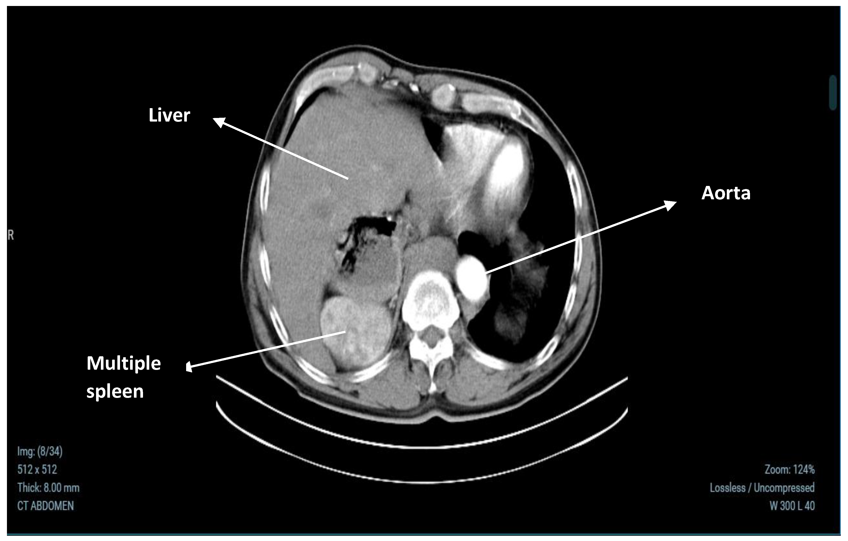 Medicina 60 02010 g002