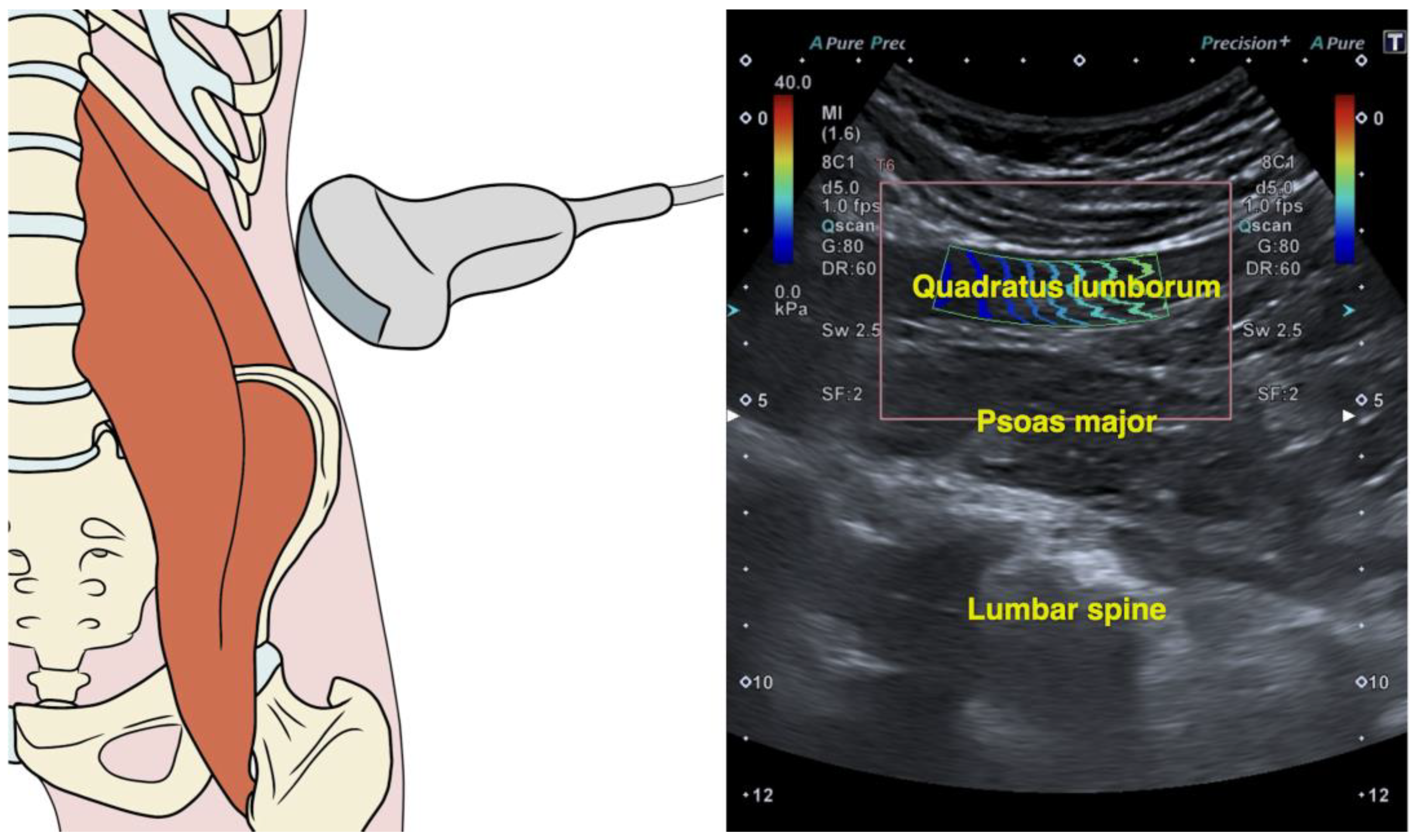 Medicina 61 00270 g001 Medicina 61 00270 g001