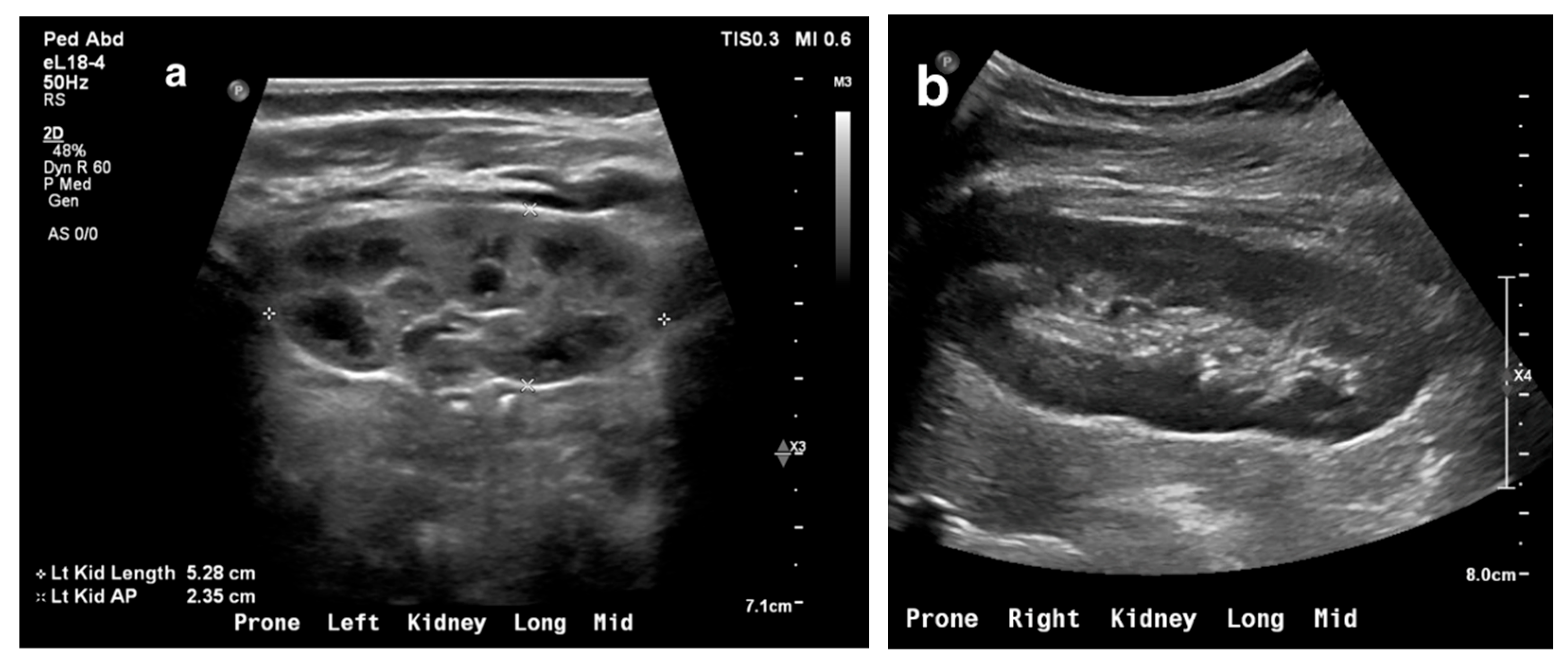 Medicina 61 00696 g001