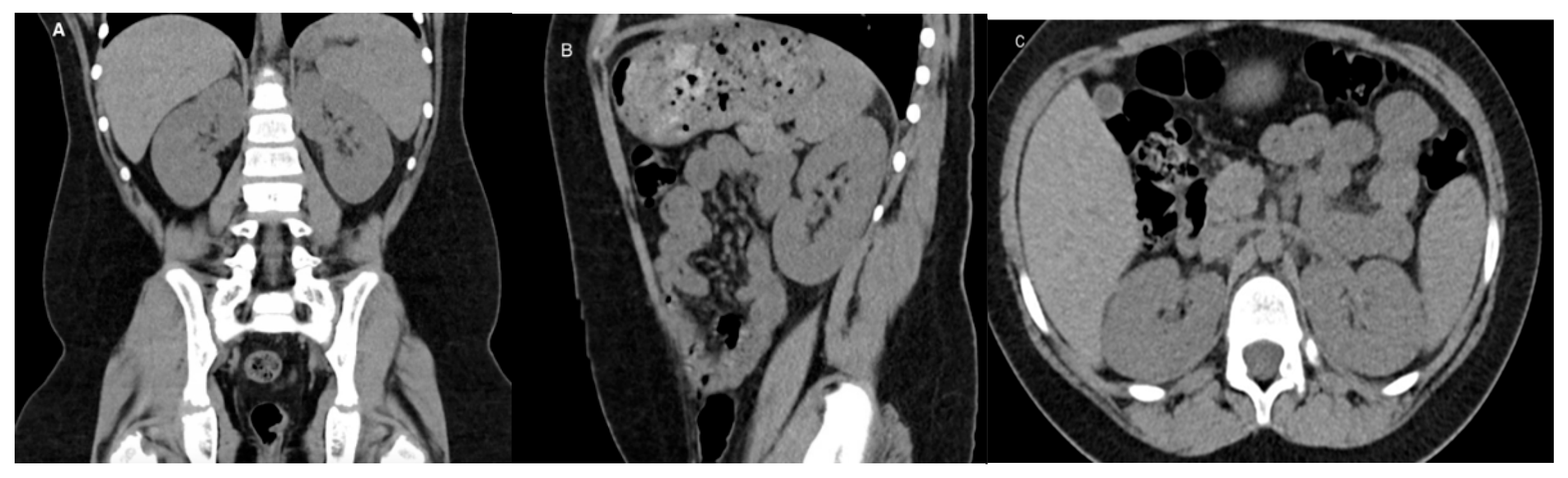 Medicina 61 00696 g003