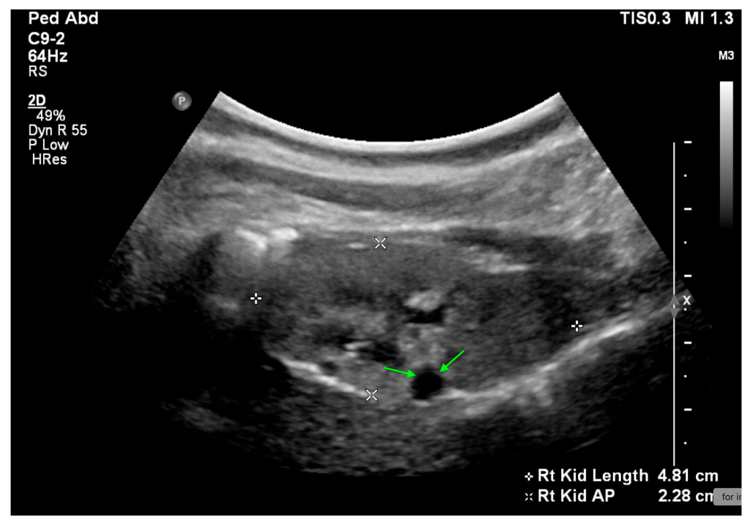 Medicina 61 00696 g008