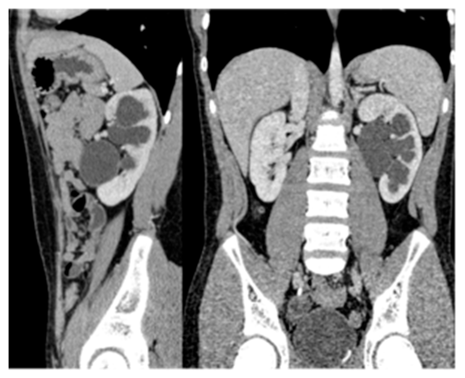 Medicina 61 00696 g011