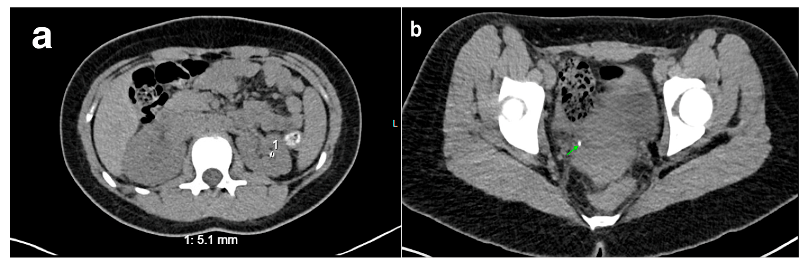 Medicina 61 00696 g022