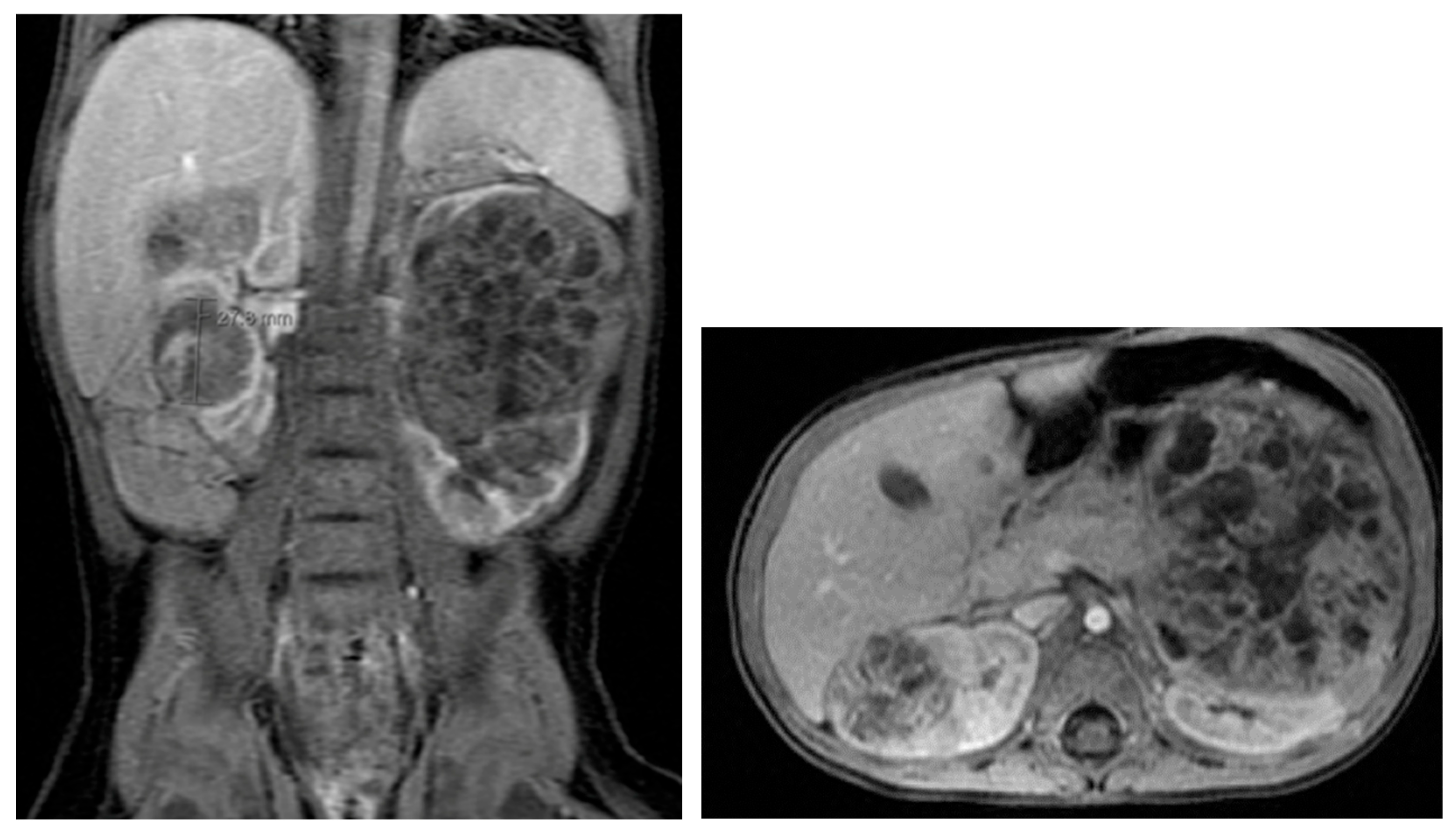 Medicina 61 00696 g027