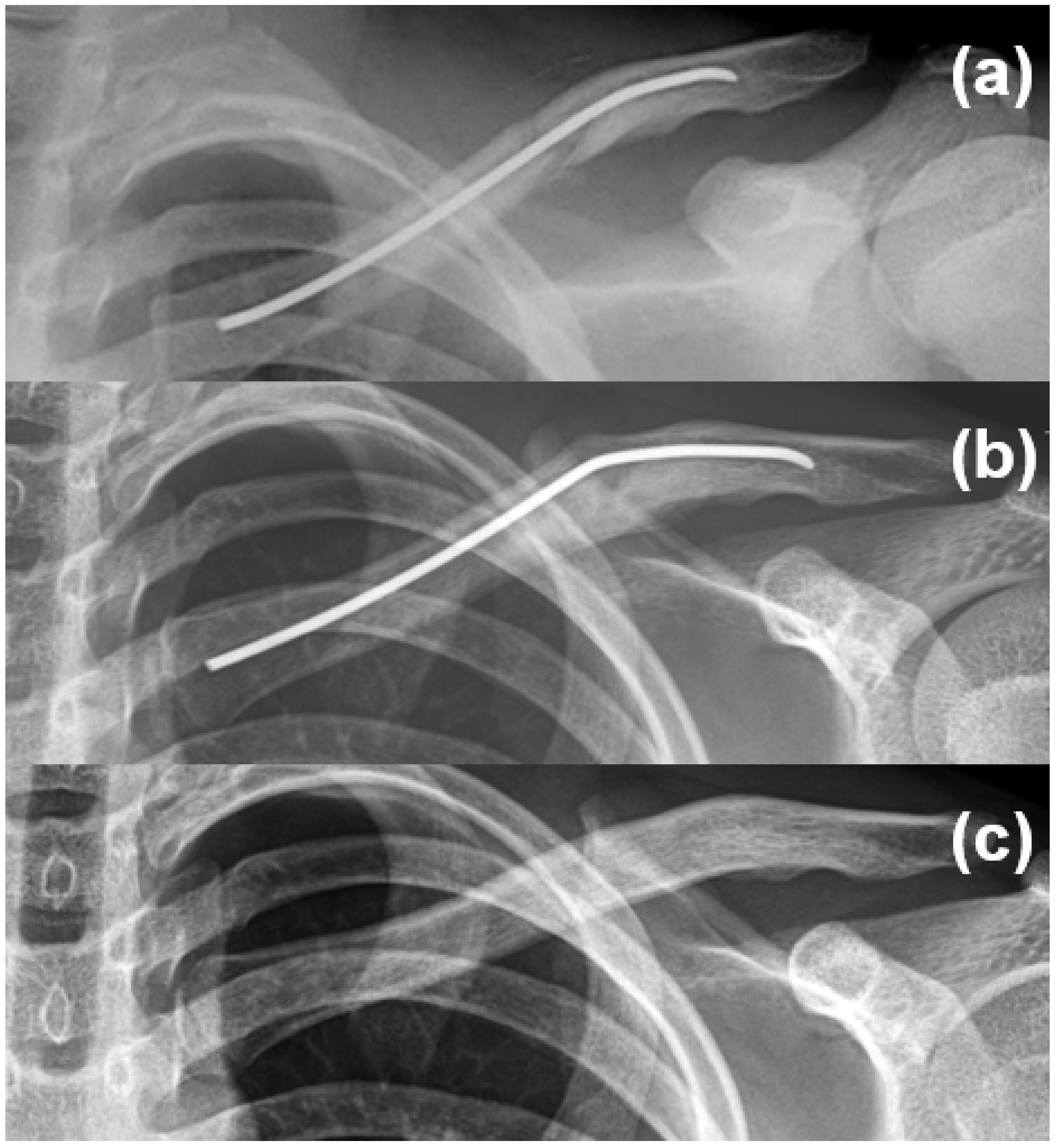 Medicina 61 01494 g002 Medicina 61 01494 g002