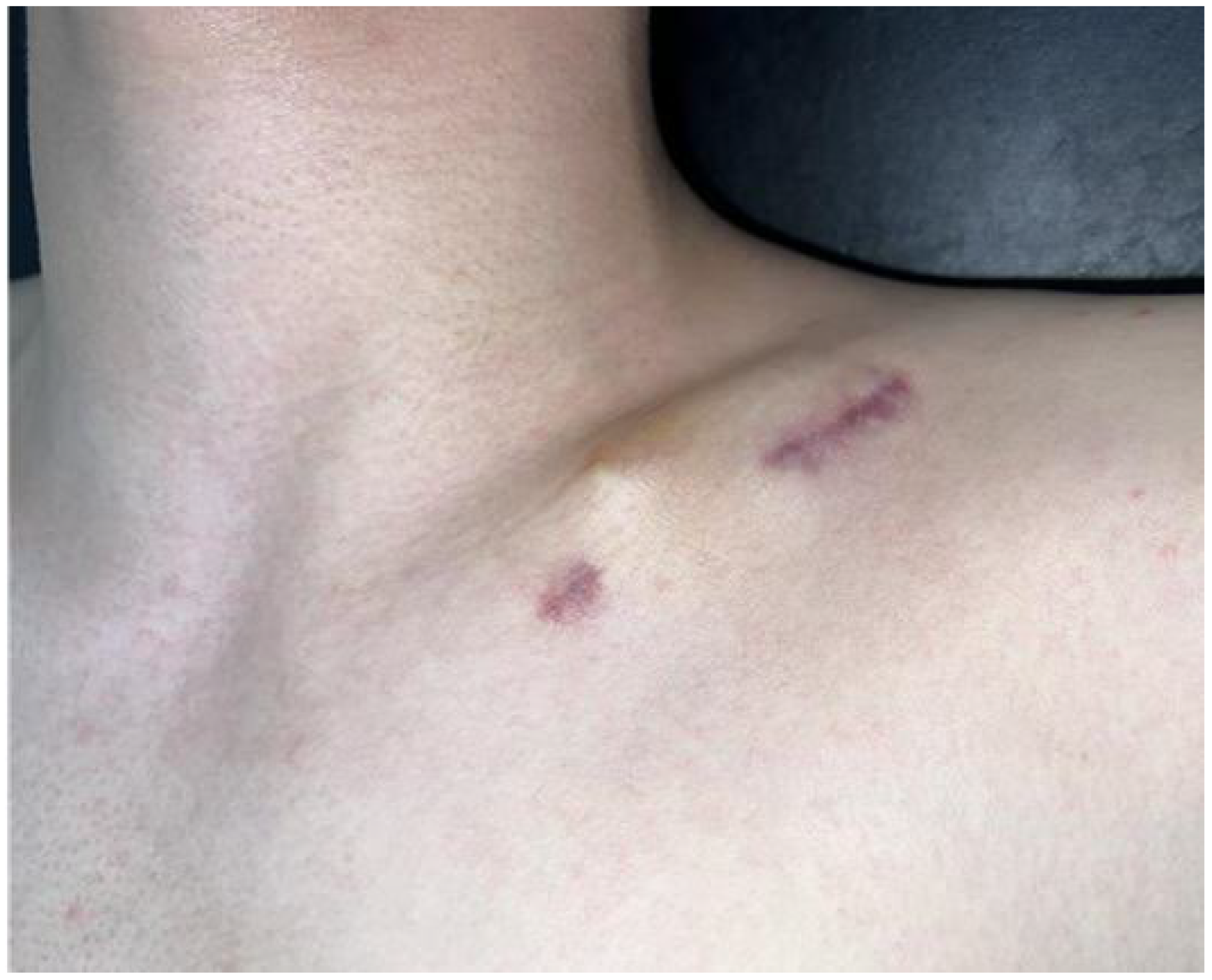 Medicina 61 01494 g003 Medicina 61 01494 g003