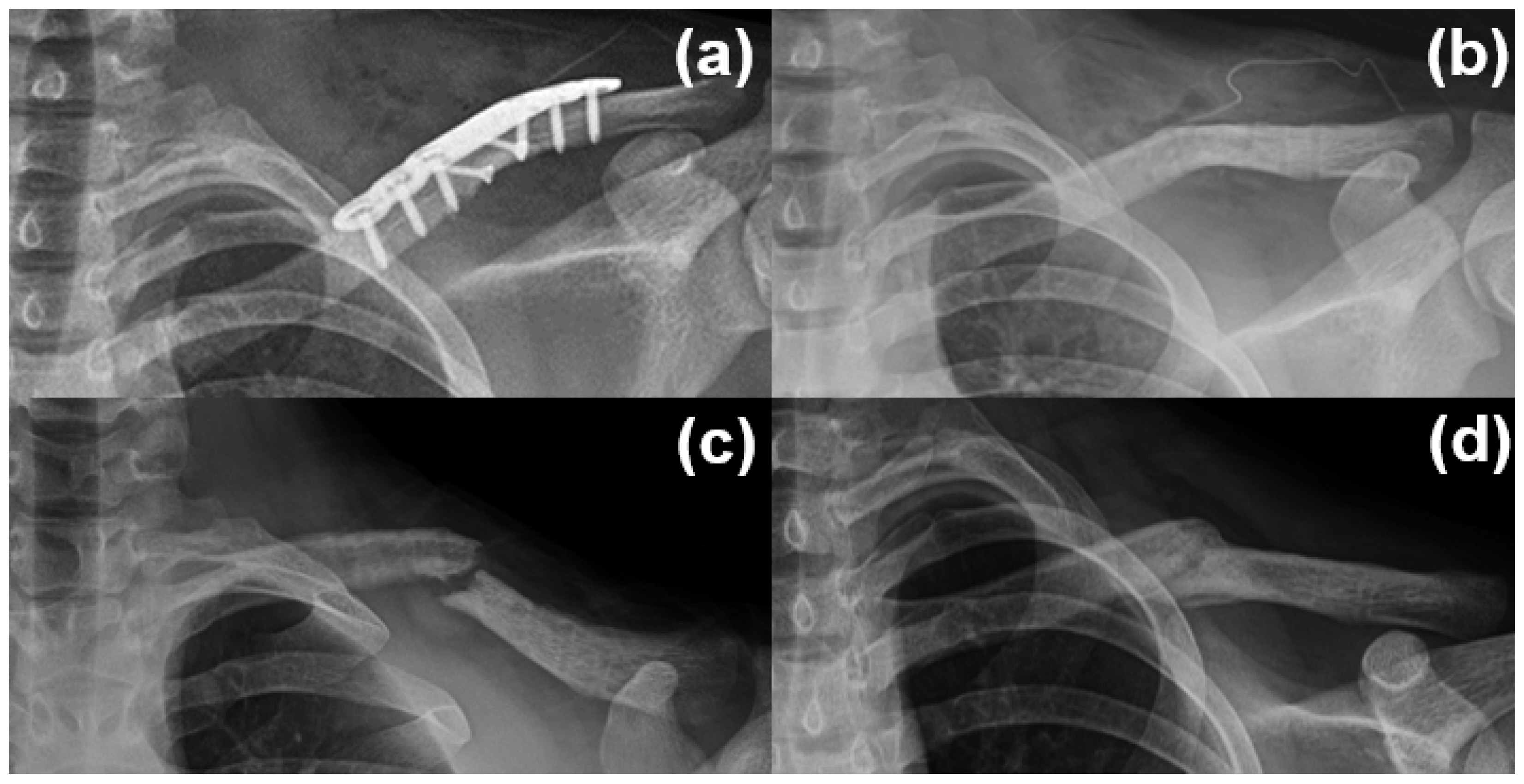 Medicina 61 01494 g004 Medicina 61 01494 g004