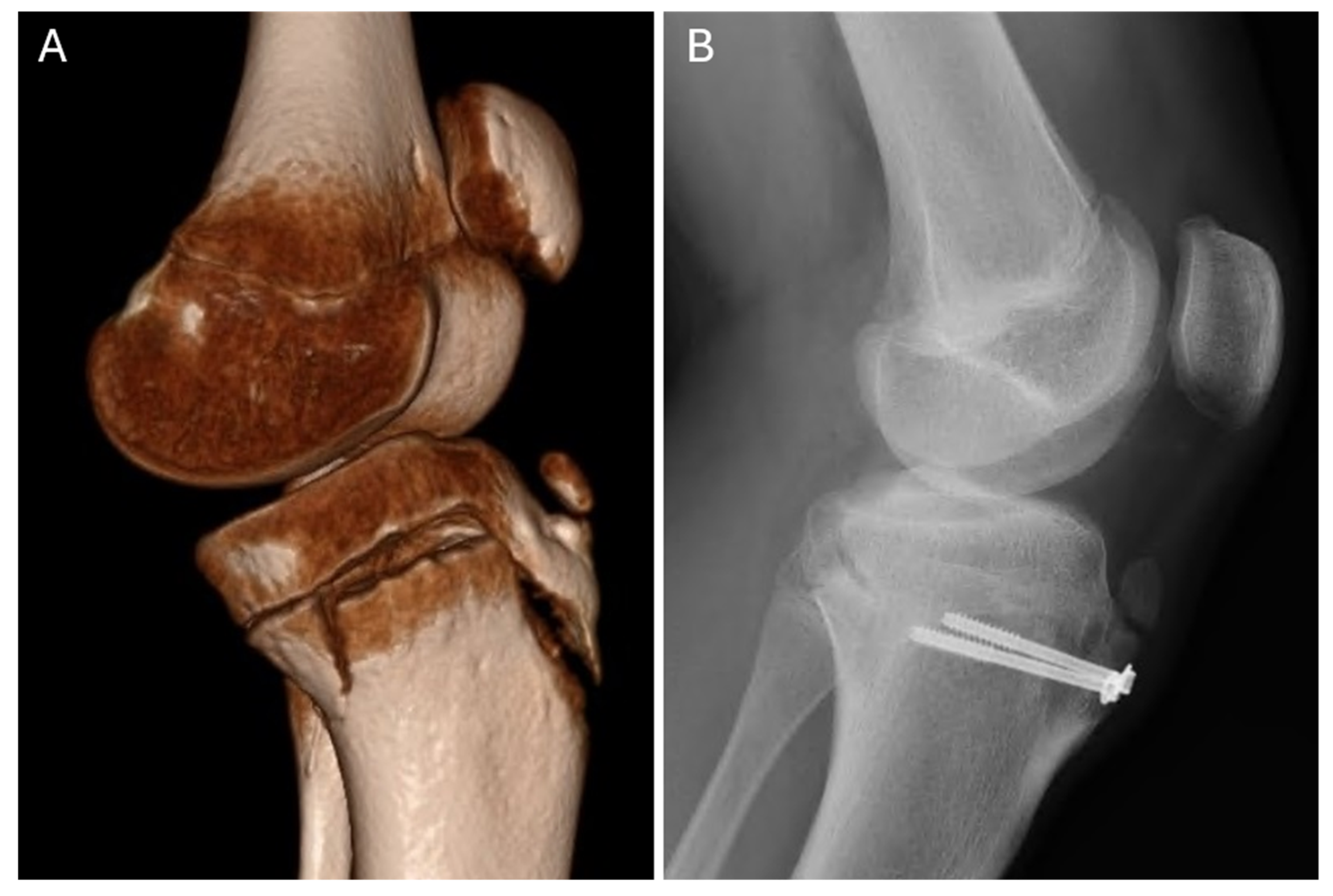 Medicina 61 01698 g003 Medicina 61 01698 g003