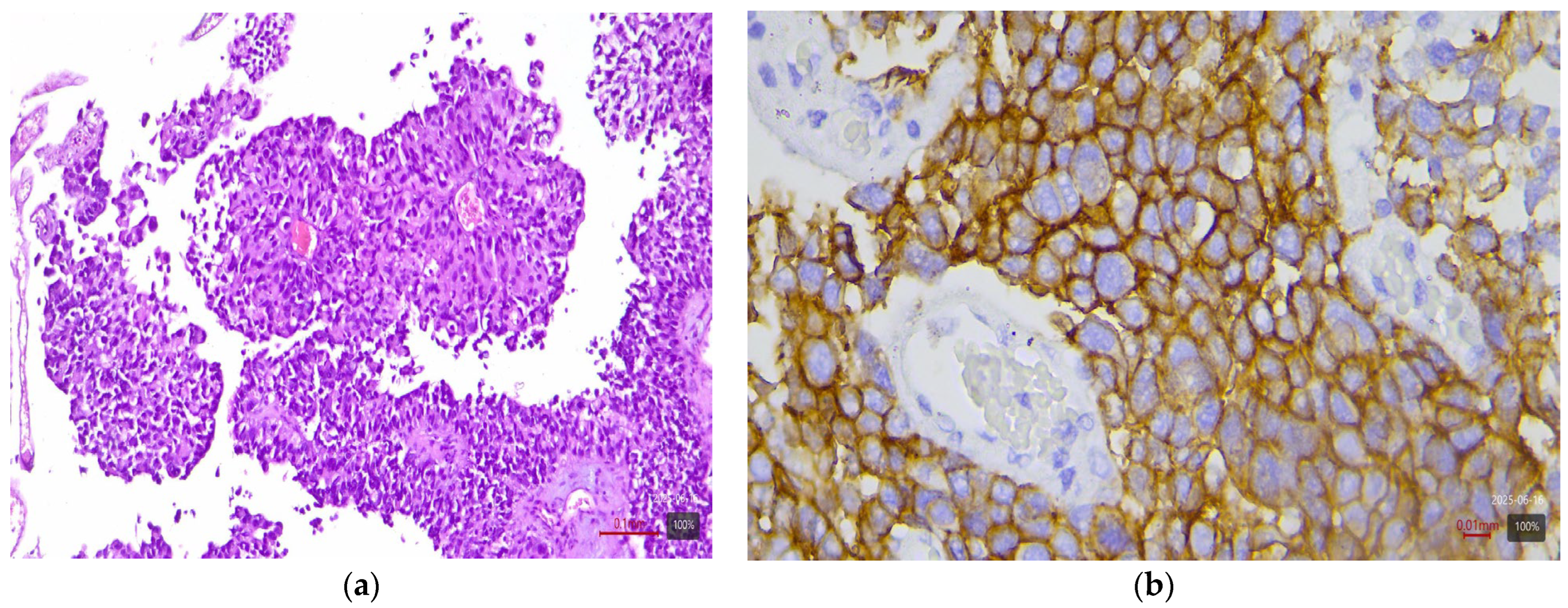 Medicina 61 01759 g001 Medicina 61 01759 g001