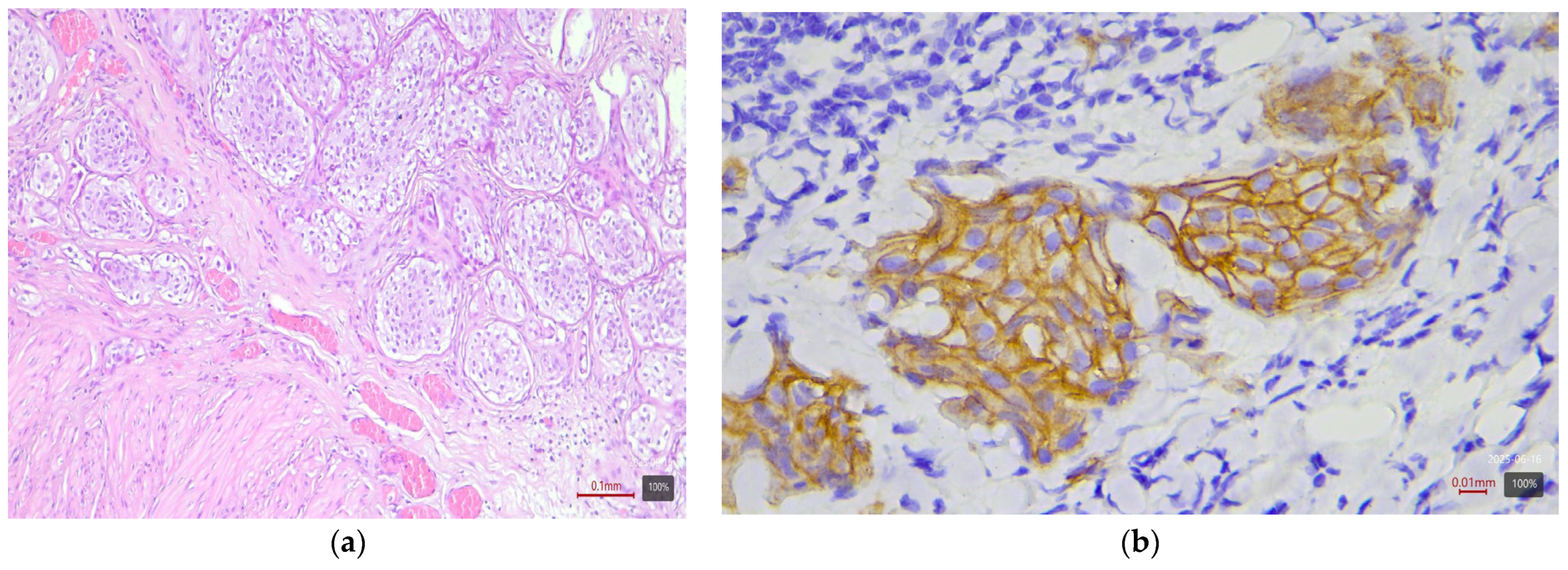 Medicina 61 01759 g004 Medicina 61 01759 g004