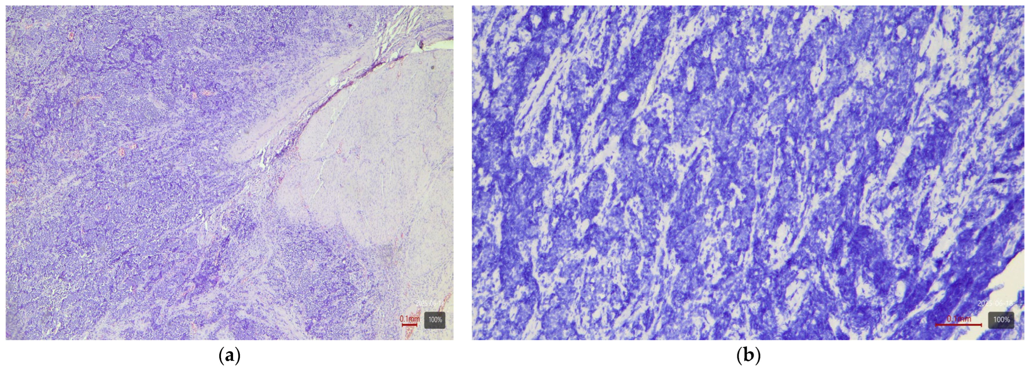 Medicina 61 01759 g005 Medicina 61 01759 g005