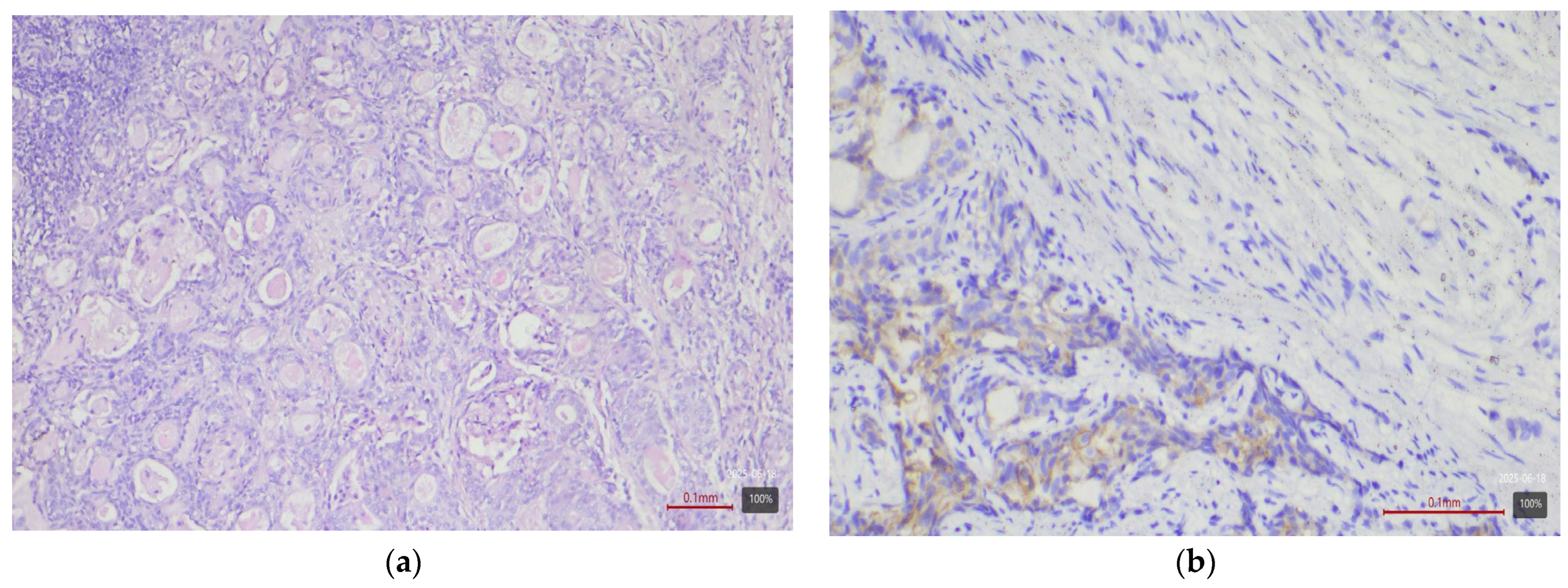 Medicina 61 01759 g006 Medicina 61 01759 g006