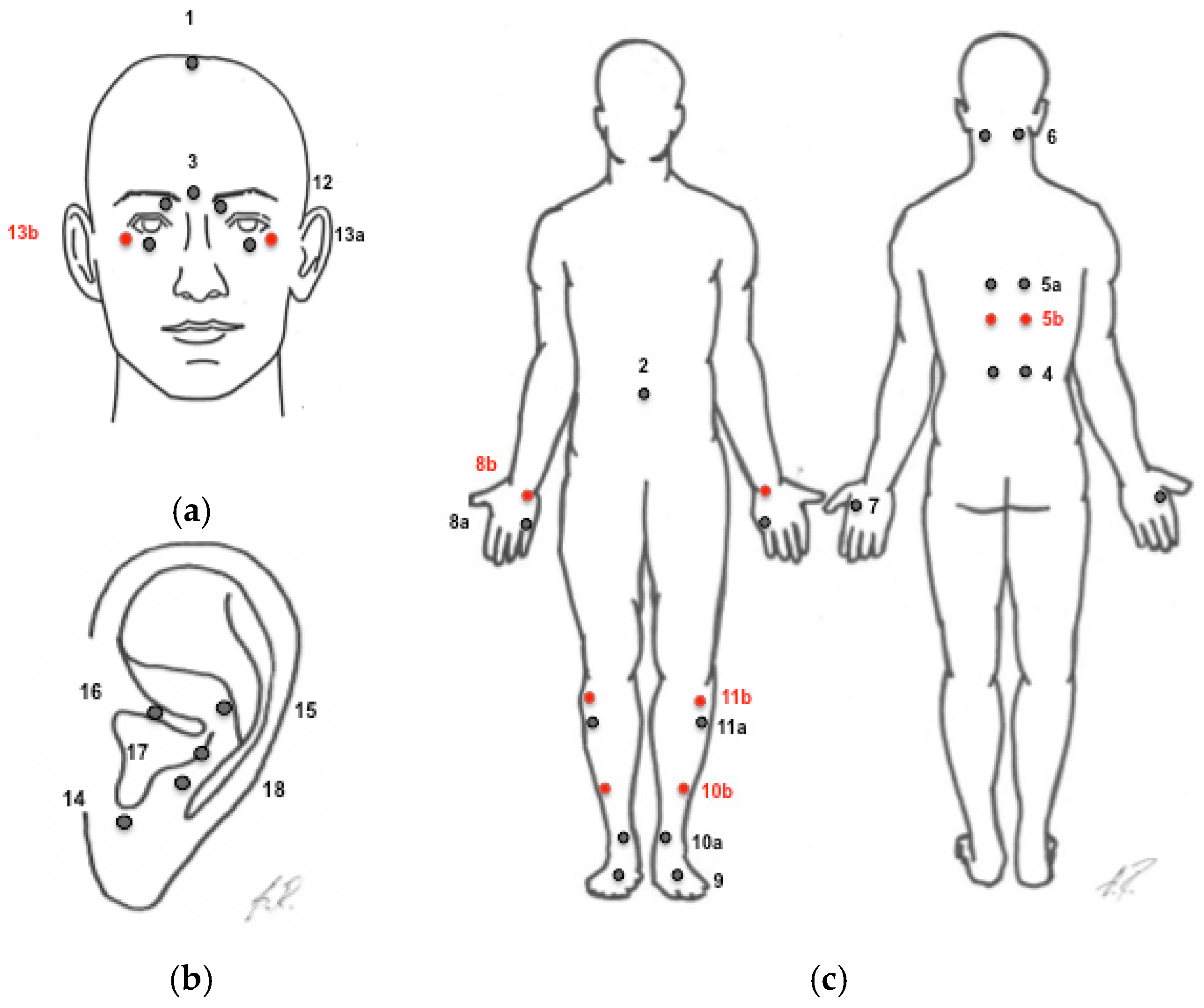 Medicines | Free Full-Text | The Effect of Acupuncture on Visual Function  in Patients with Congenital and Acquired Nystagmus