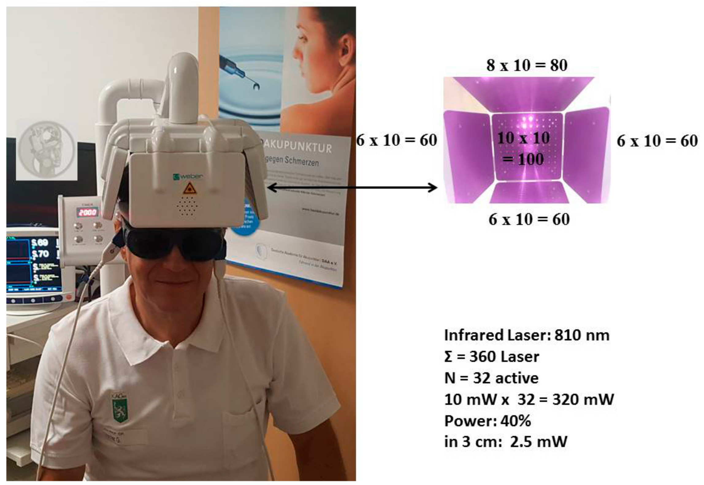 Medicines | Free Full-Text | Transcranial Laser Stimulation Research—A New  Helmet and First Data from Near Infrared Spectroscopy