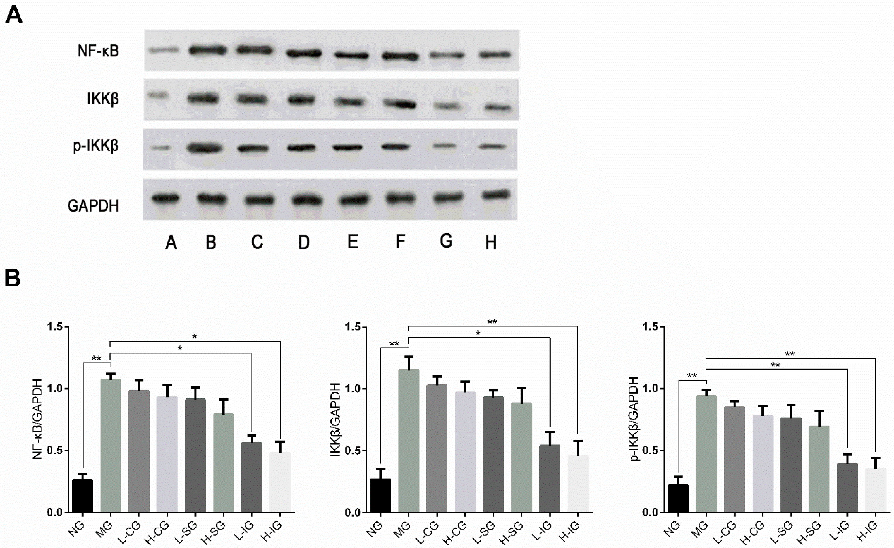 Medicines Free Full Text Effects Of Shugan Jianpi Recipe On The Expression Of The P38 Mapk Nf Kb Signaling Pathway In The Hepatocytes Of Nafld Rats Html