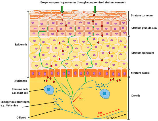 Medicines Free Full Text Breaking The Itch Scratch Cycle Topical Options For The Management Of Chronic Cutaneous Itch In Atopic Dermatitis Html