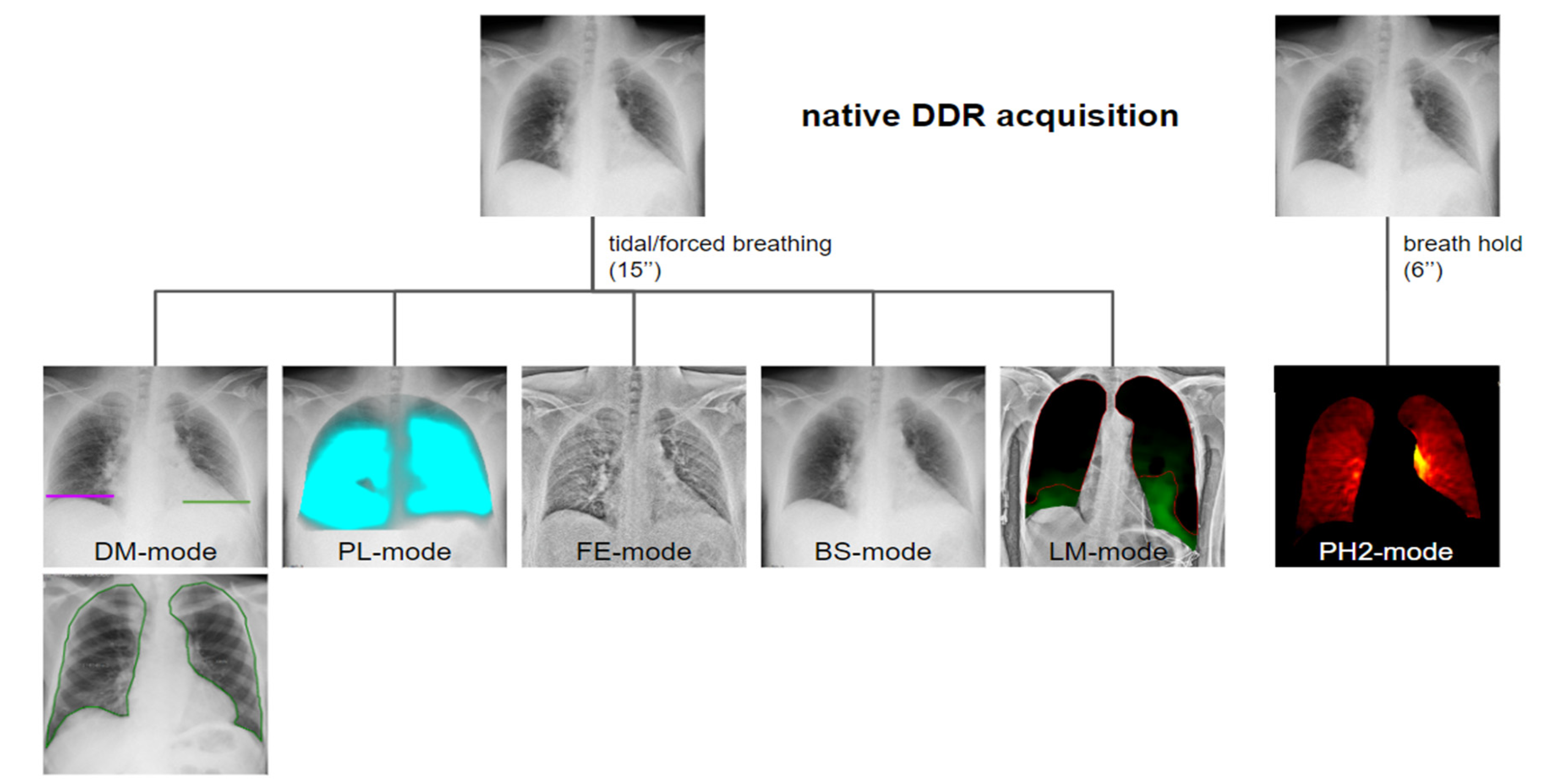 medicine, irradiation / X-ray / measurement, abdominal cavity and thorax,  x-ray cinematography, 20th century, 20th century, X-ray, X-raying,  angiography, pneumography, chest, thorax, rib cage, ribcage, thoraxes,  respiratory system, respiratory systems