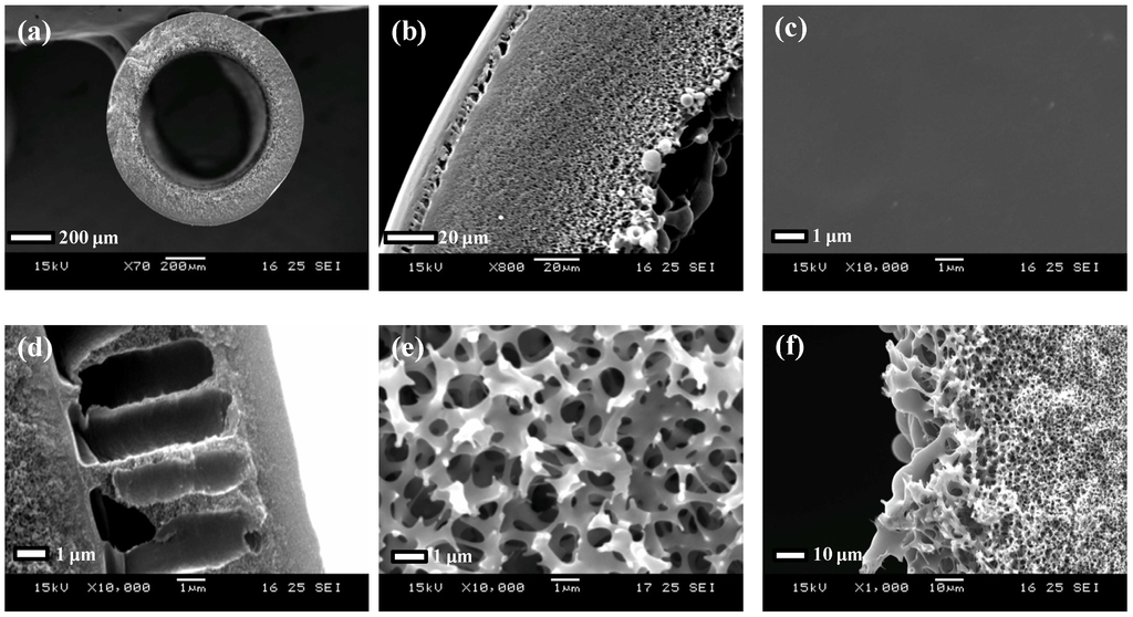 Membranes | Free Full-Text | Gypsum (CaSO4·2H2O) Scaling on  Polybenzimidazole and Cellulose Acetate Hollow Fiber Membranes under  Forward Osmosis