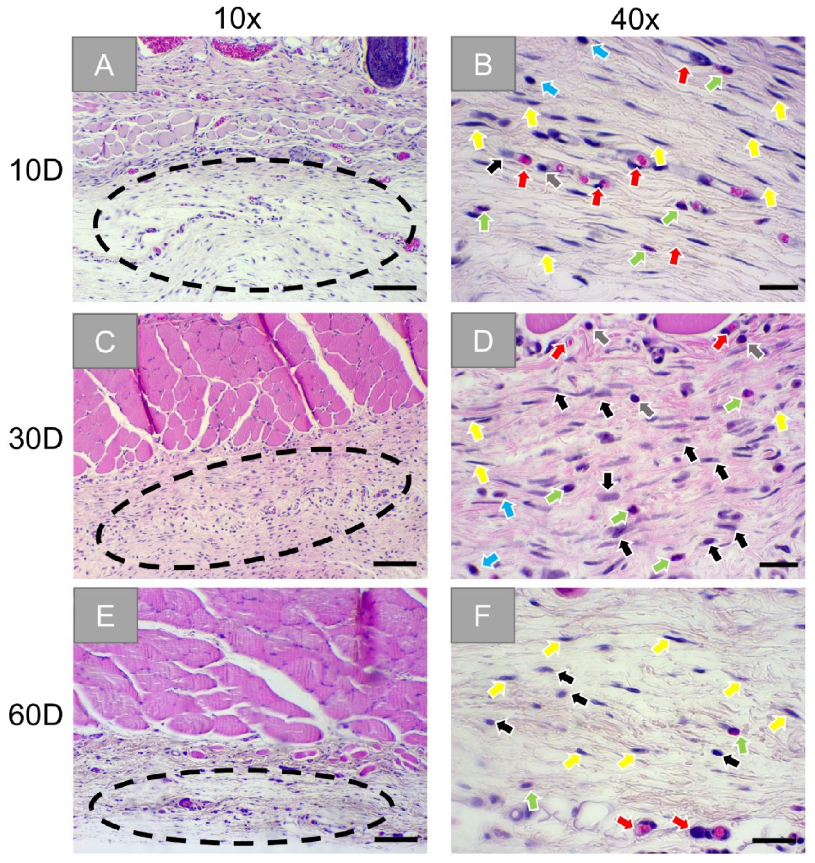 Membranes Free Full Text Comparative In Vivo Analysis Of The Integration Behavior And Immune Response Of Collagen Based Dental Barrier Membranes For Guided Bone Regeneration Gbr Html