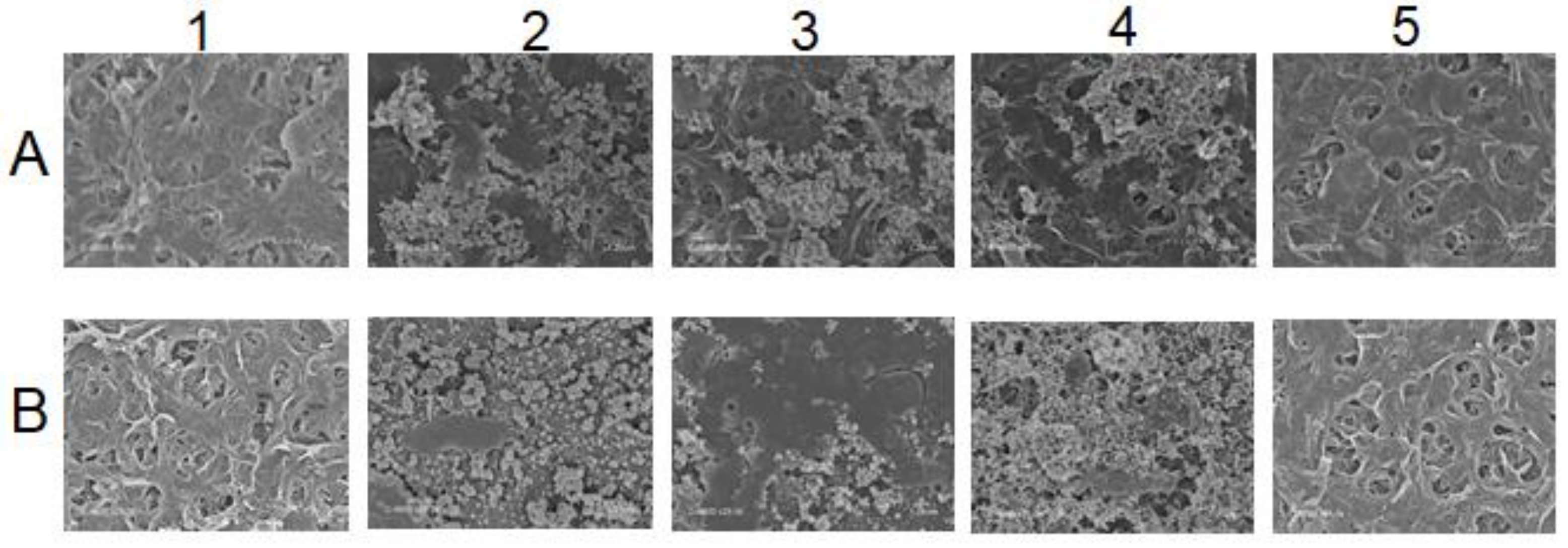 Membranes 12 00341 g006