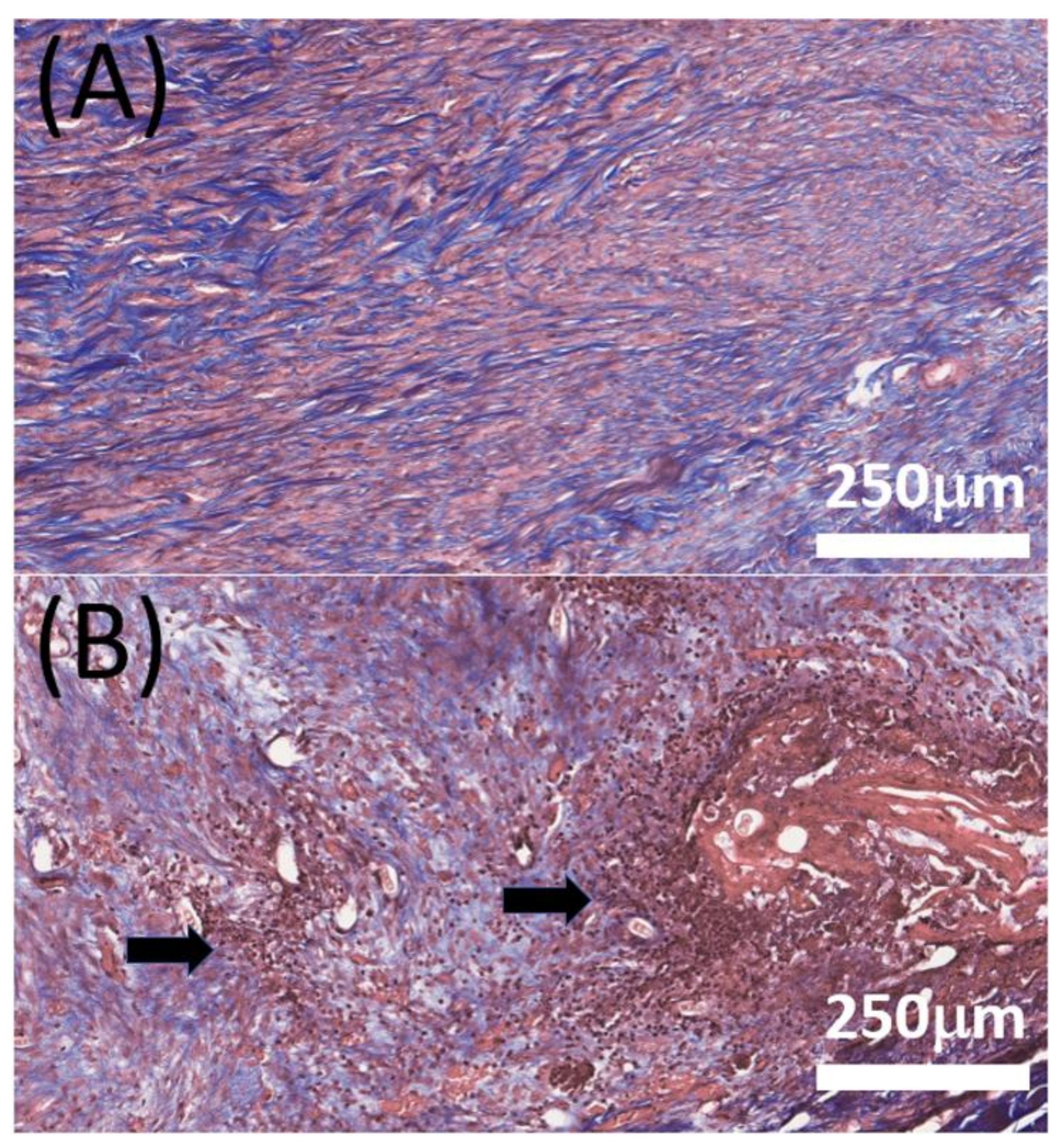 Membranes 12 00529 g007