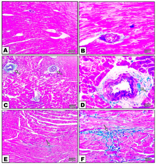 Metabolites 12 00635 g004a