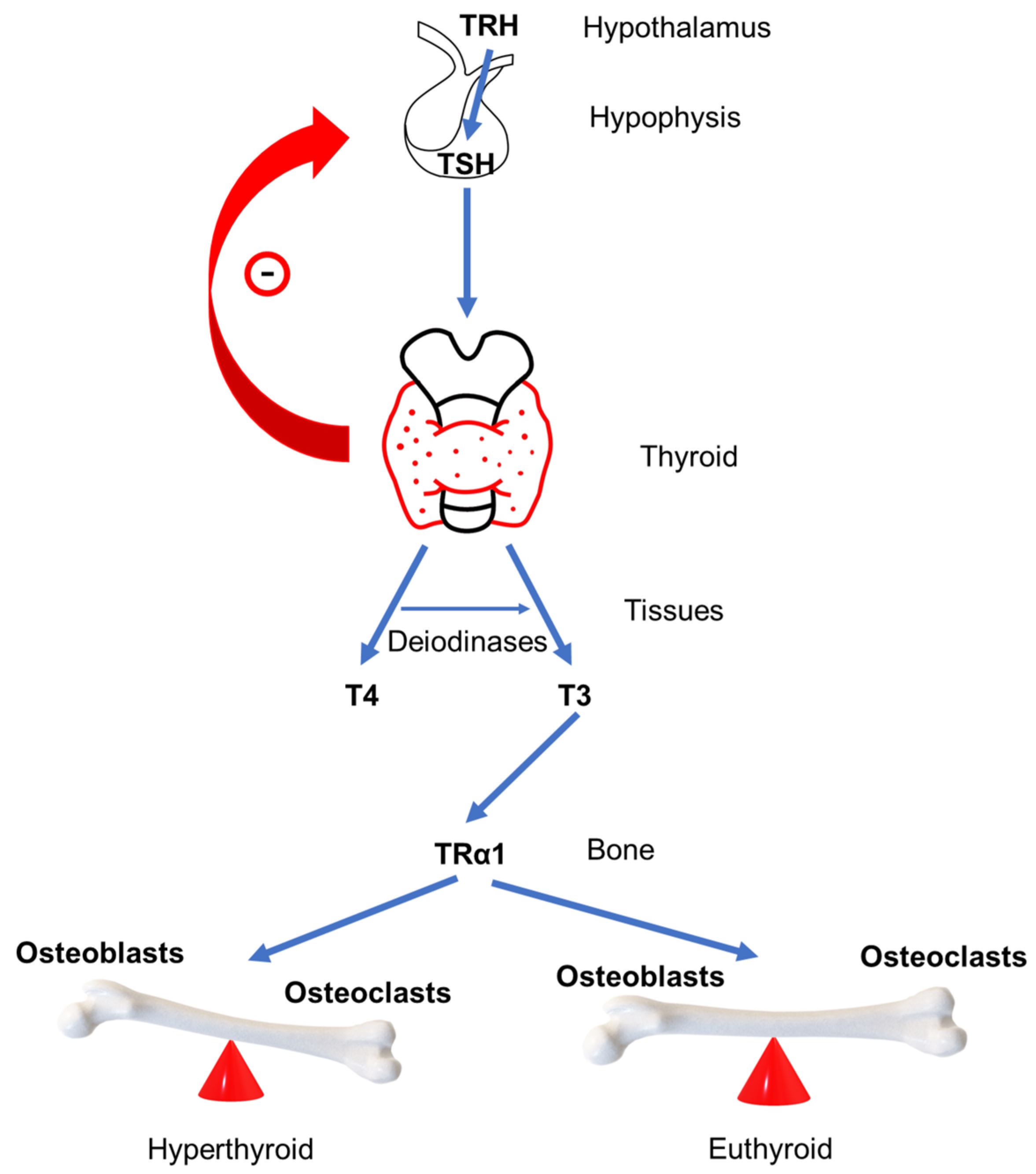 Metabolites | Free Full-Text | Hyperthyroidism and Wnt Signaling Pathway:  Influence on Bone Remodeling
