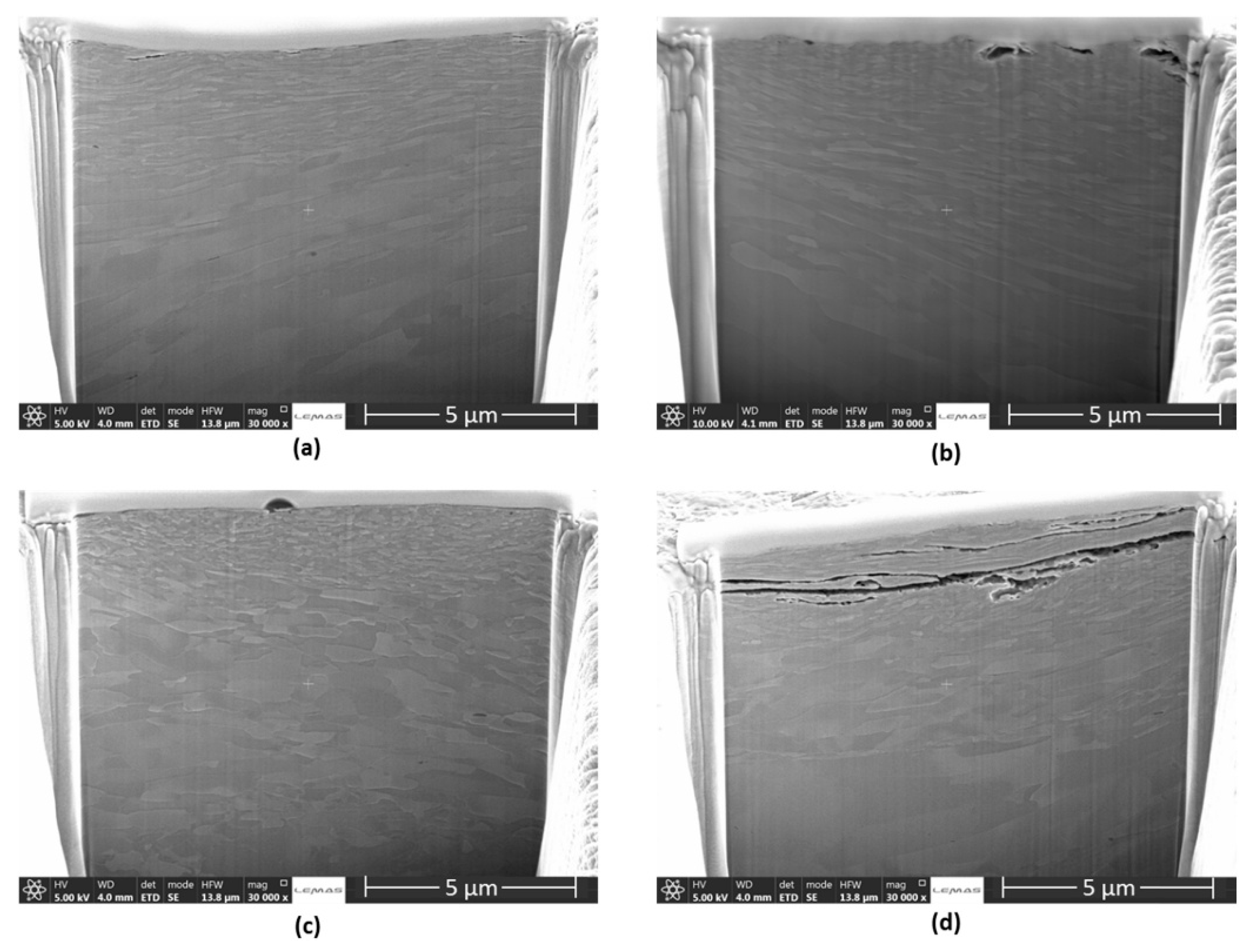 Metals 10 00180 g020