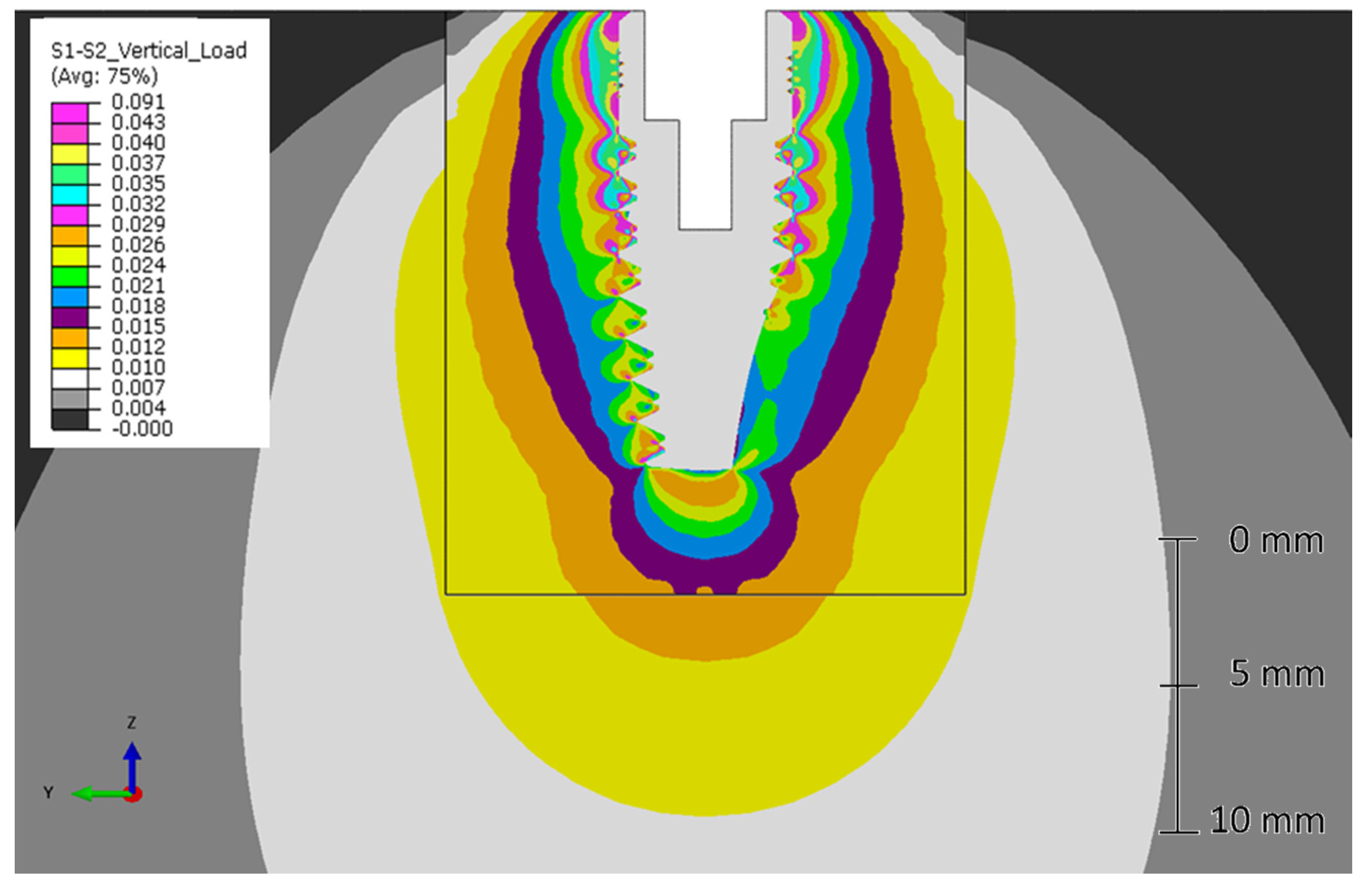 Metals 10 00648 g007 Metals 10 00648 g007
