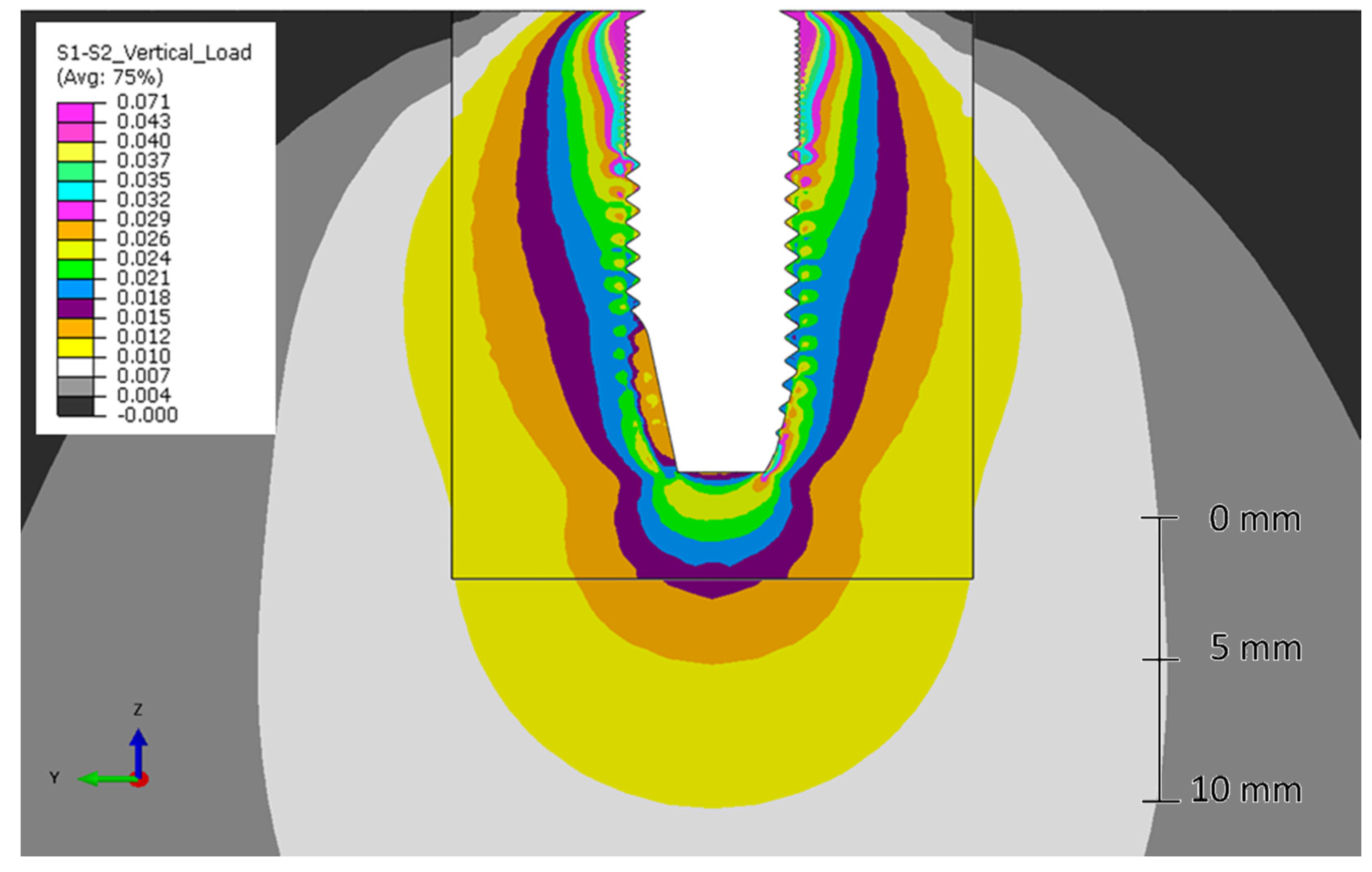 Metals 10 00648 g009 Metals 10 00648 g009