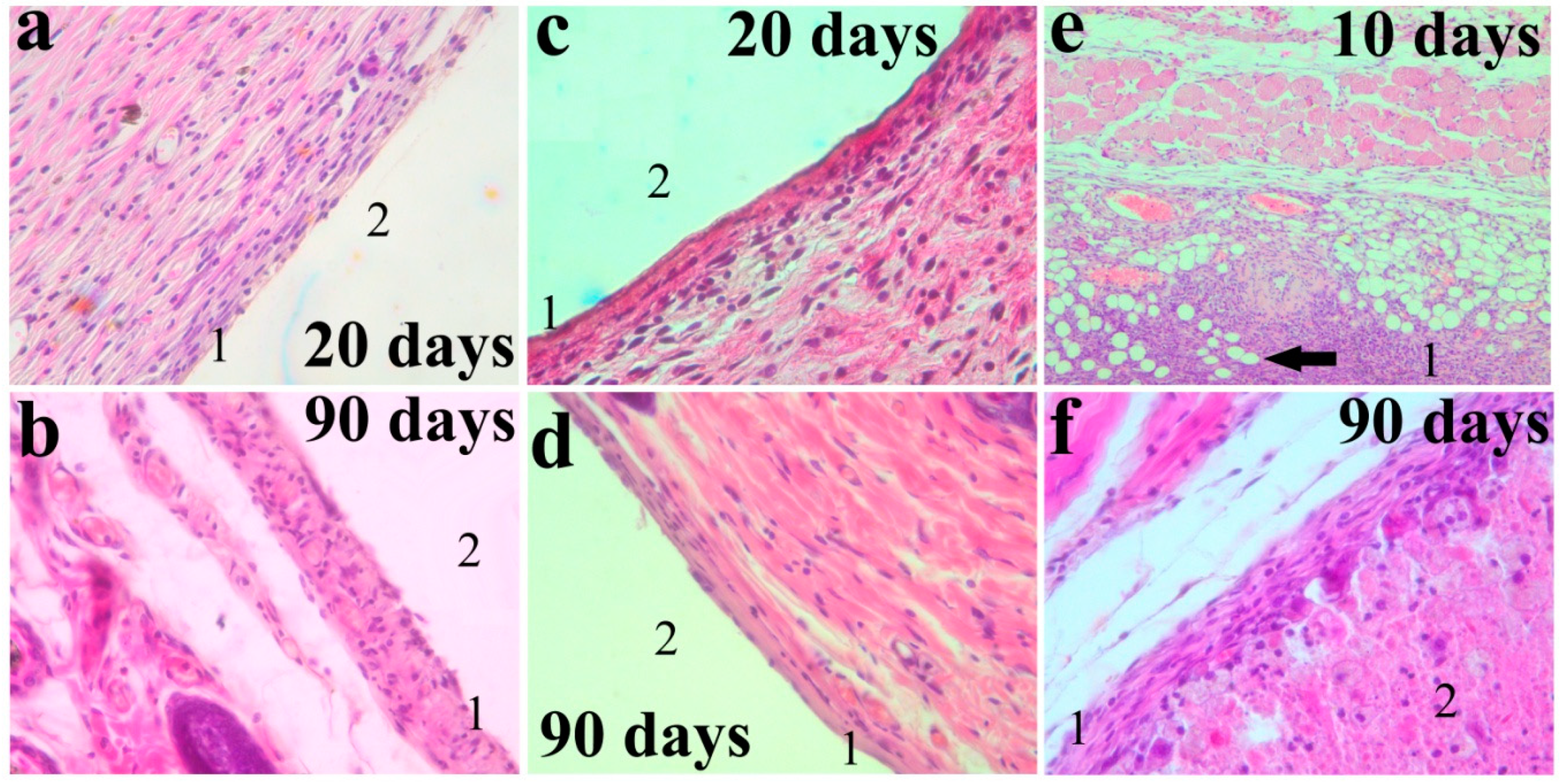 Metals 10 00867 g005 Metals 10 00867 g005