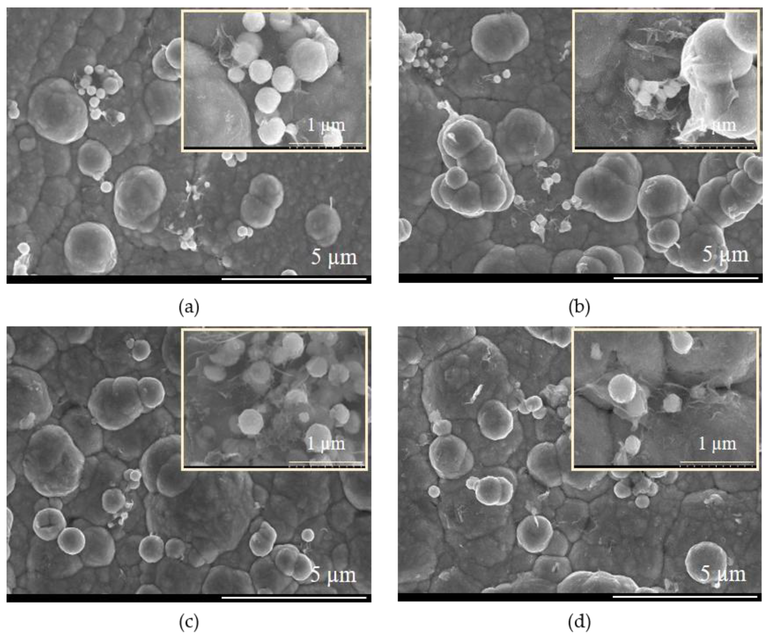 Metals 10 01455 g005