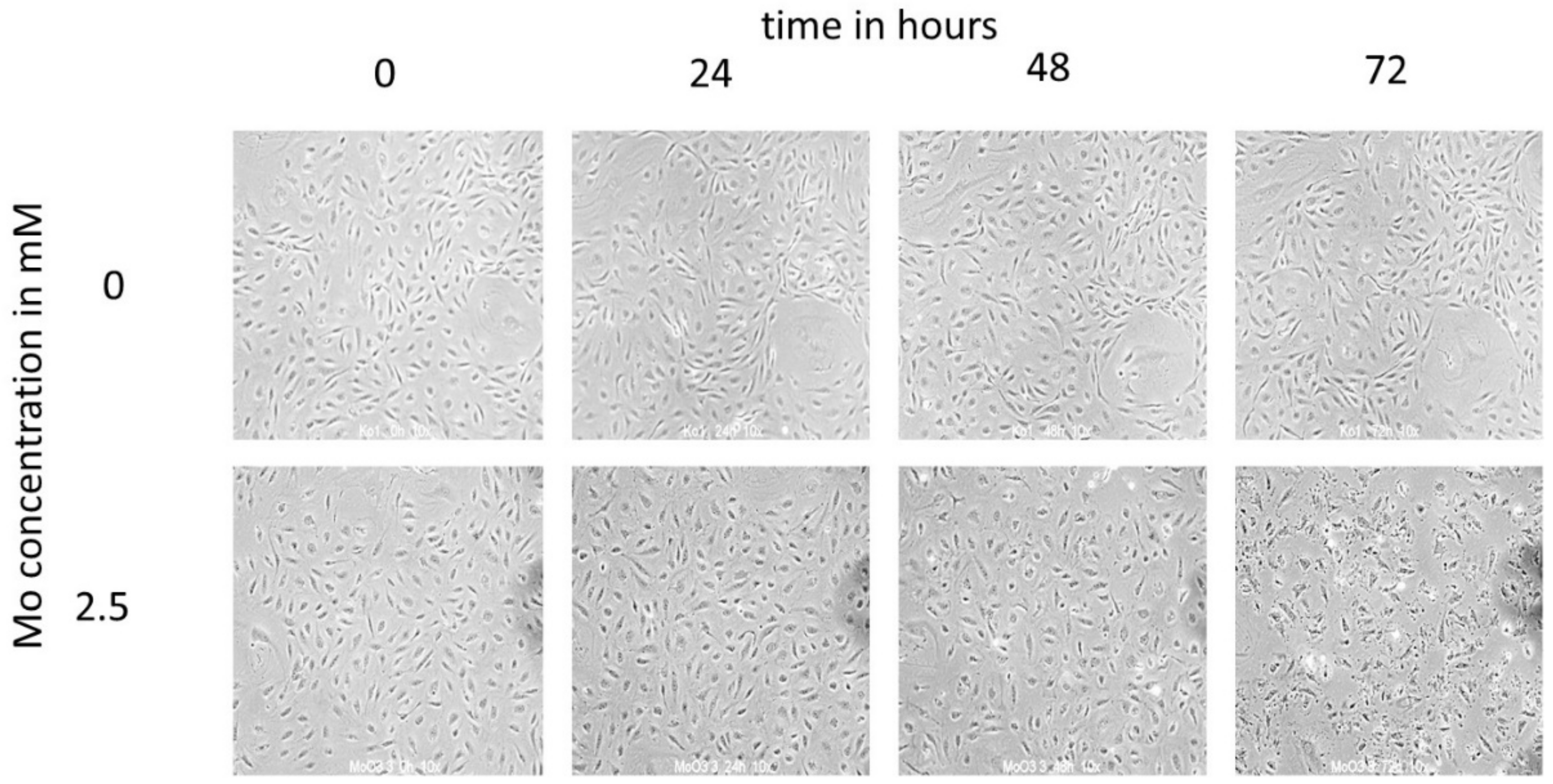 Metals 11 00761 g004