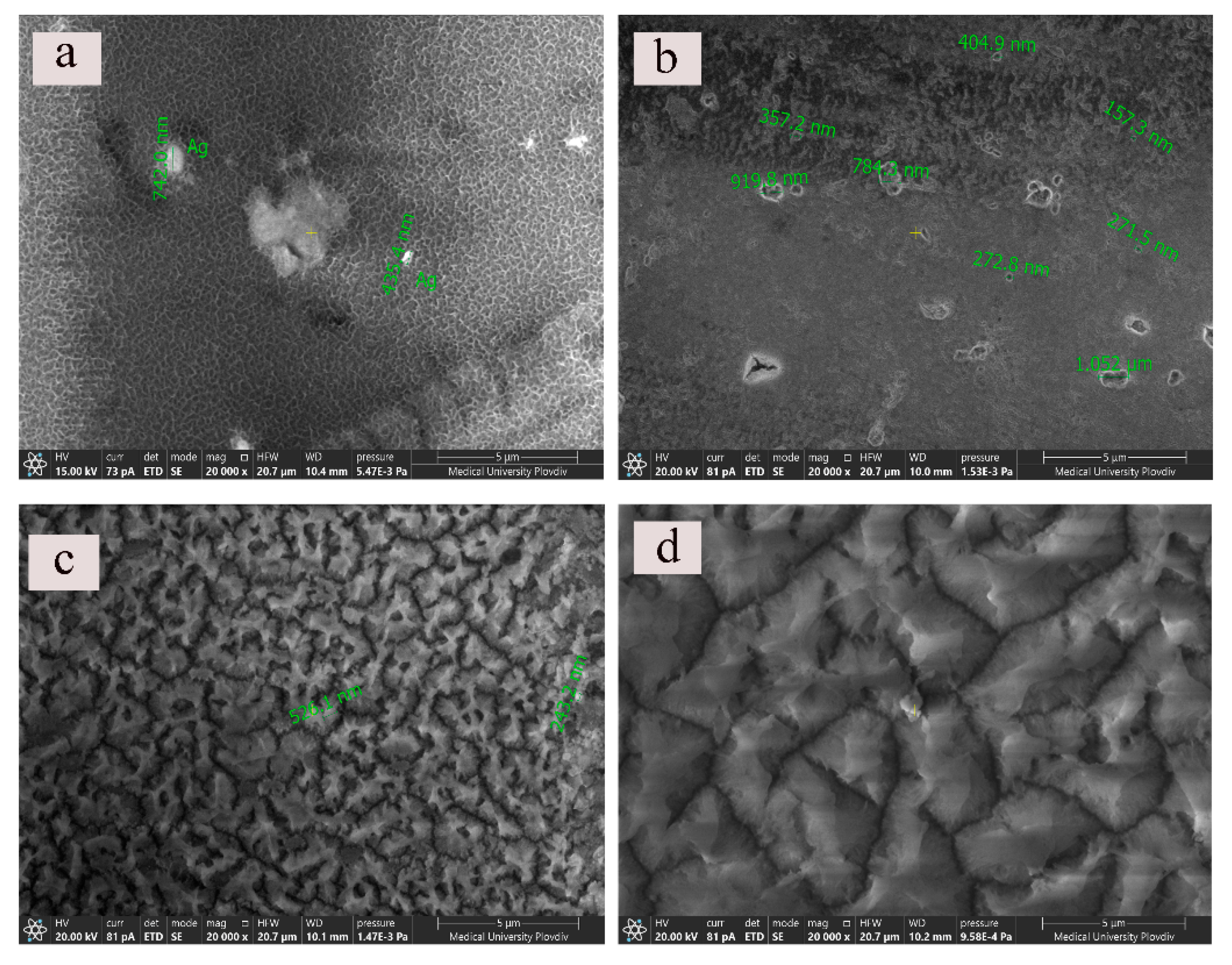 Metals 12 00051 g003
