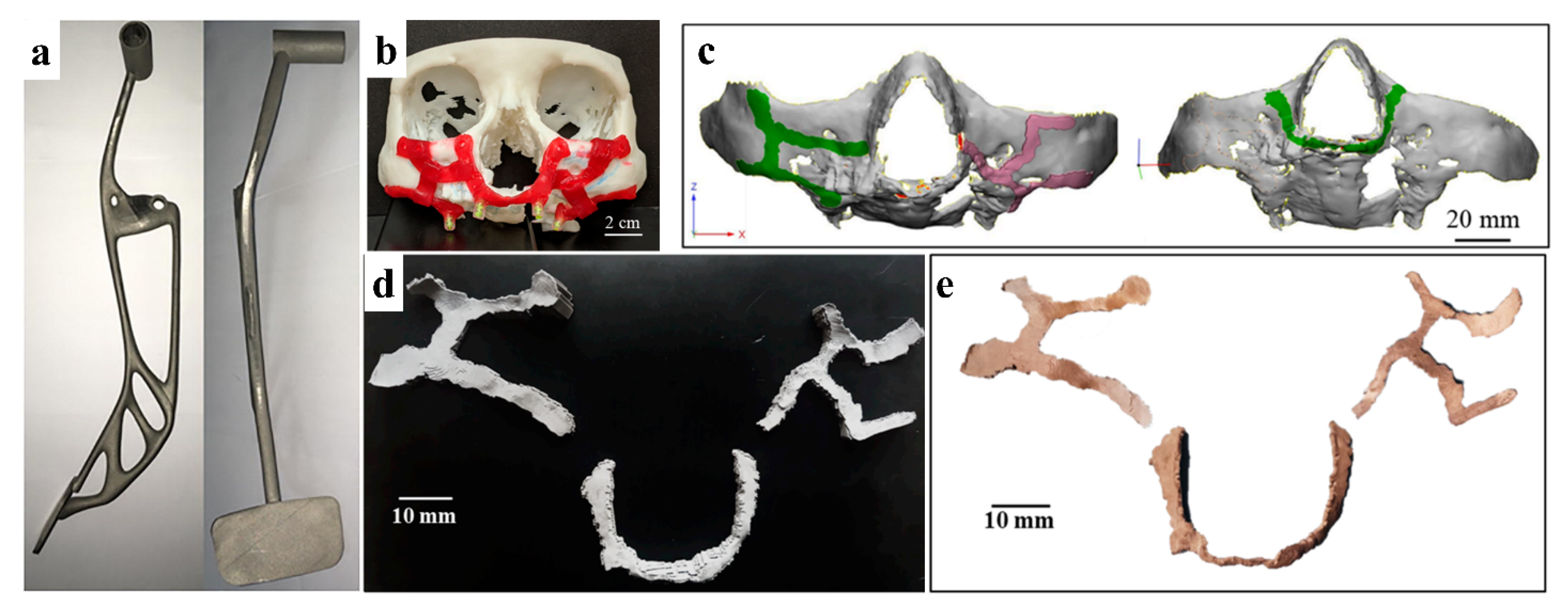 Metals 12 00429 g025